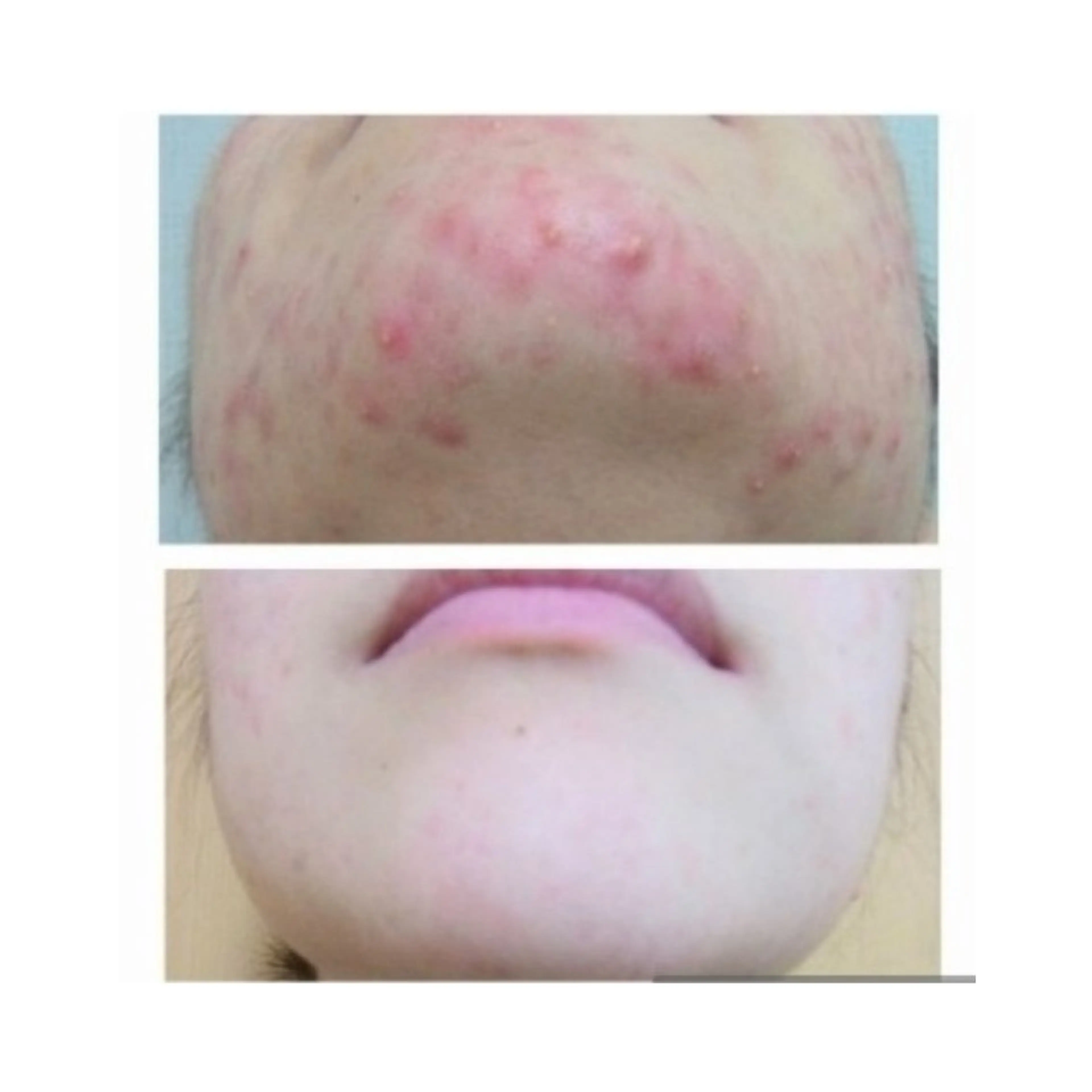 肌質改善専門サロン 川島 彩のエステ・リラクイメージ