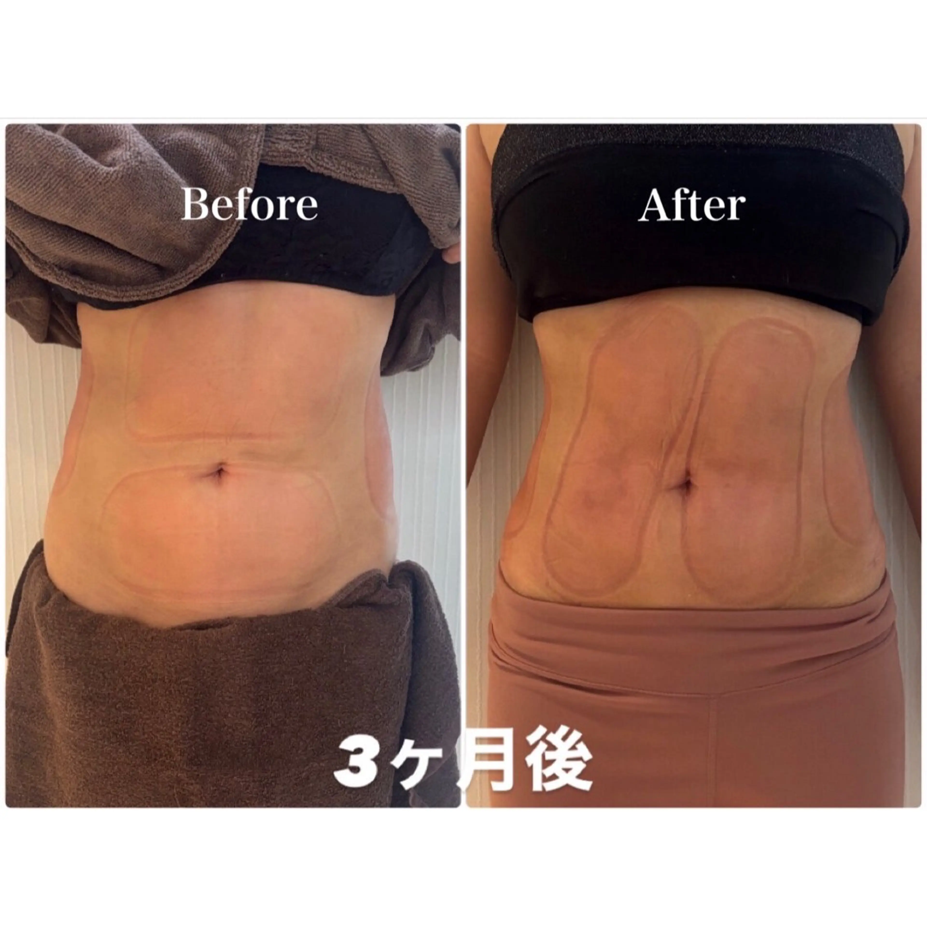 エステ 脂肪冷却痩身サロン SHIFT 東京のエステ・リラクイメージ