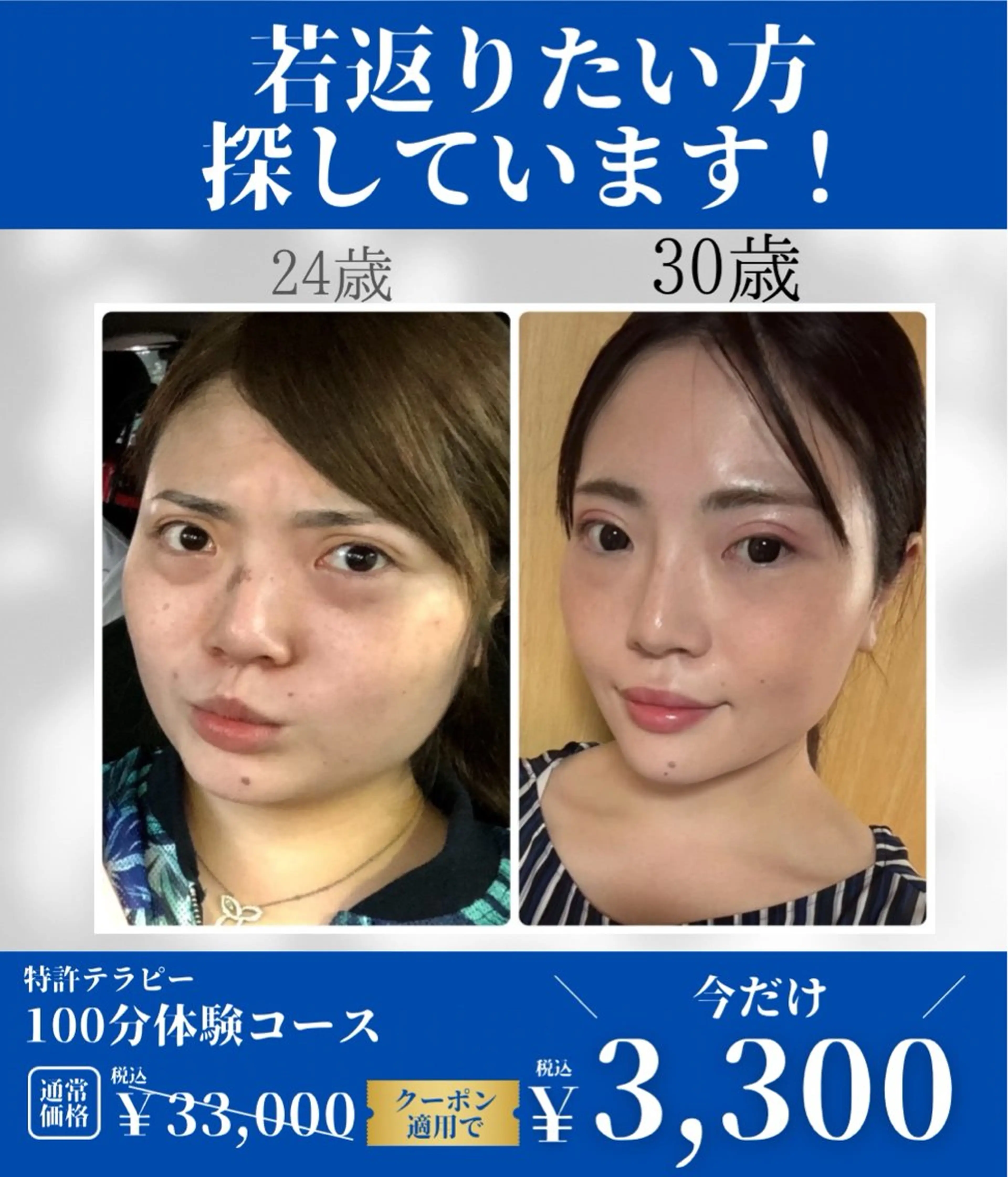 【先着10名様限定★感動リフトアップ100分】の写真