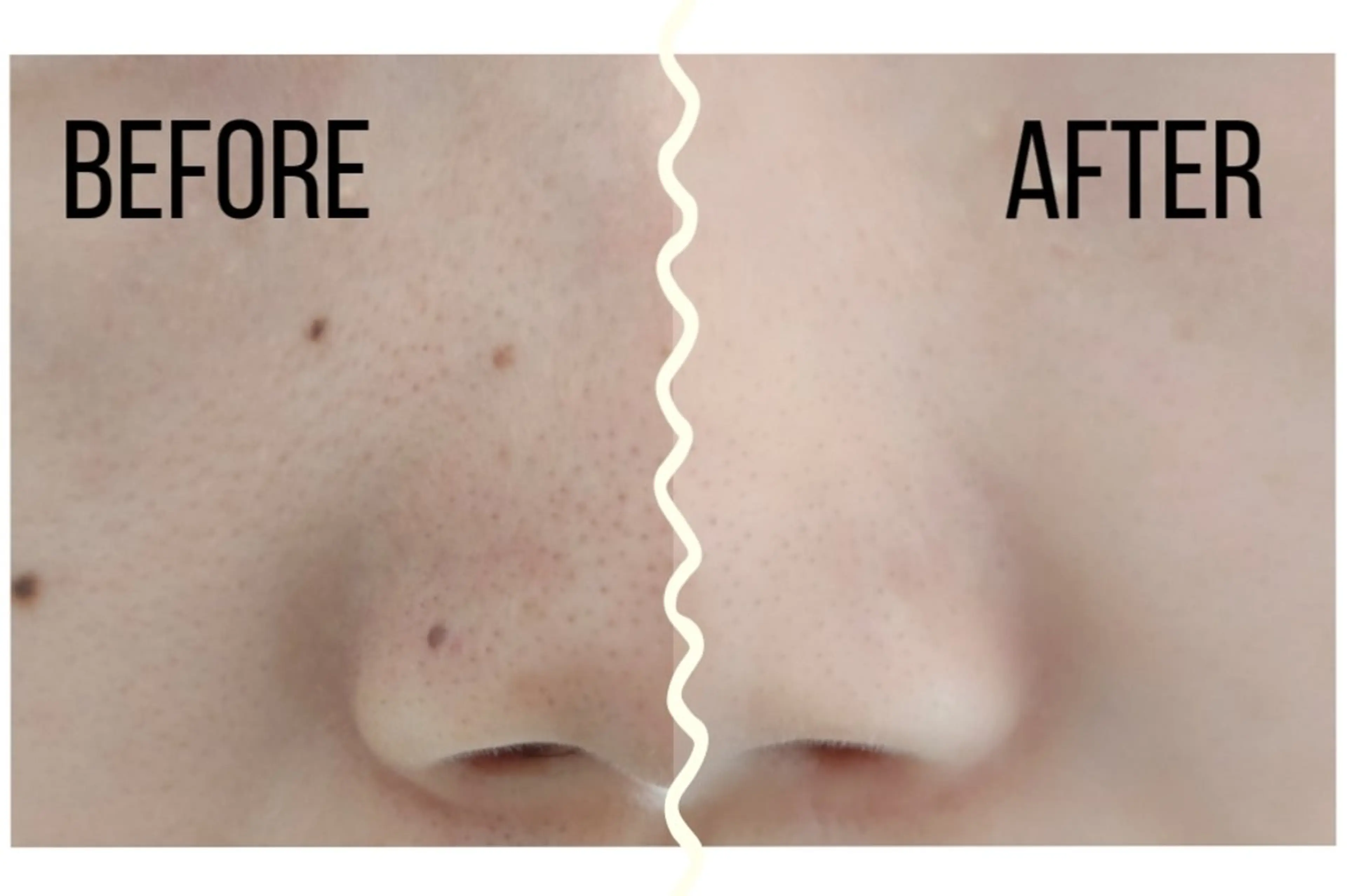 Rainy みたけ店のマツエク・マツパデザイン