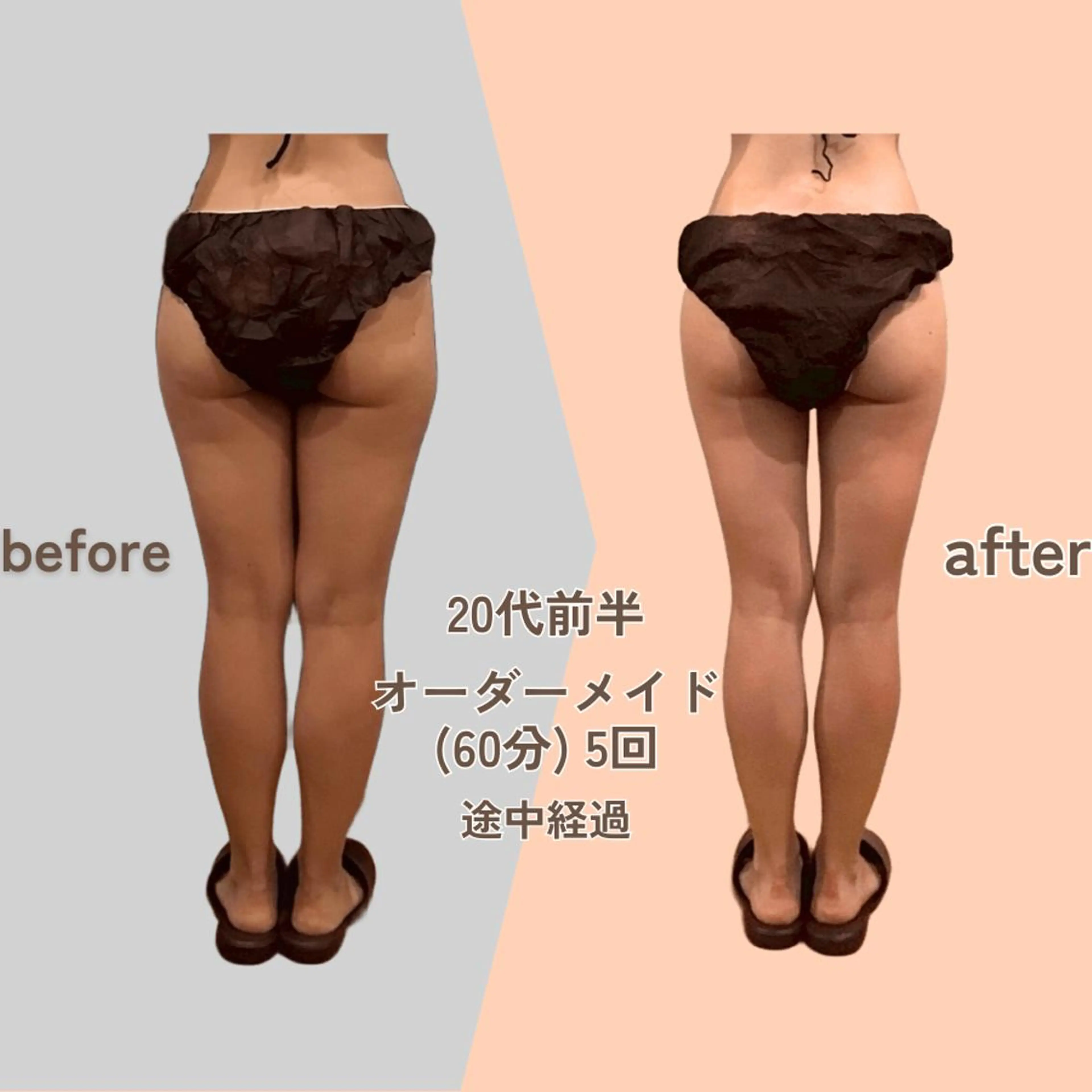 痩身エステ Julien麹町店のエステ・リラクイメージ