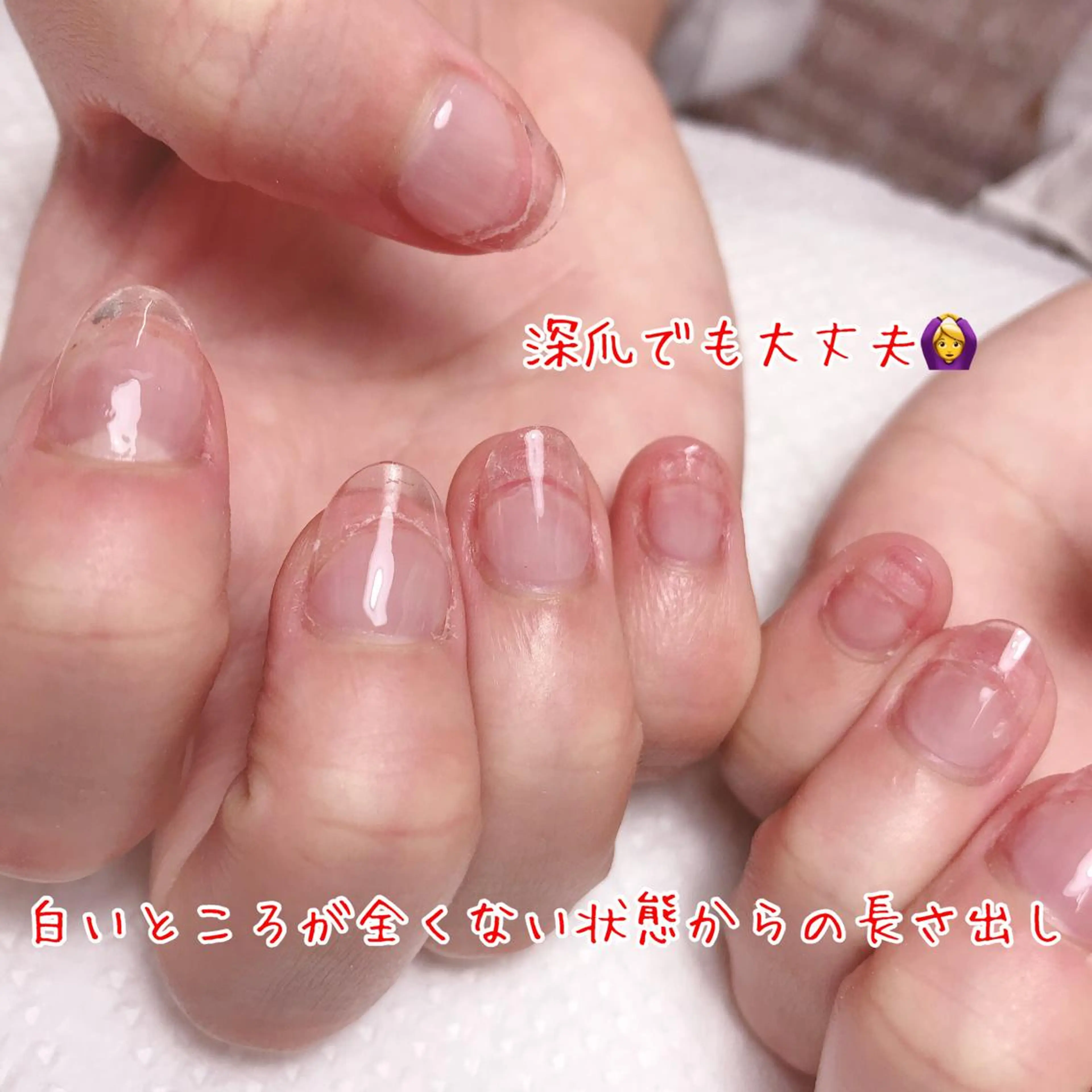 ネイル 深爪を断らない スカルプ高評価店のネイルデザイン