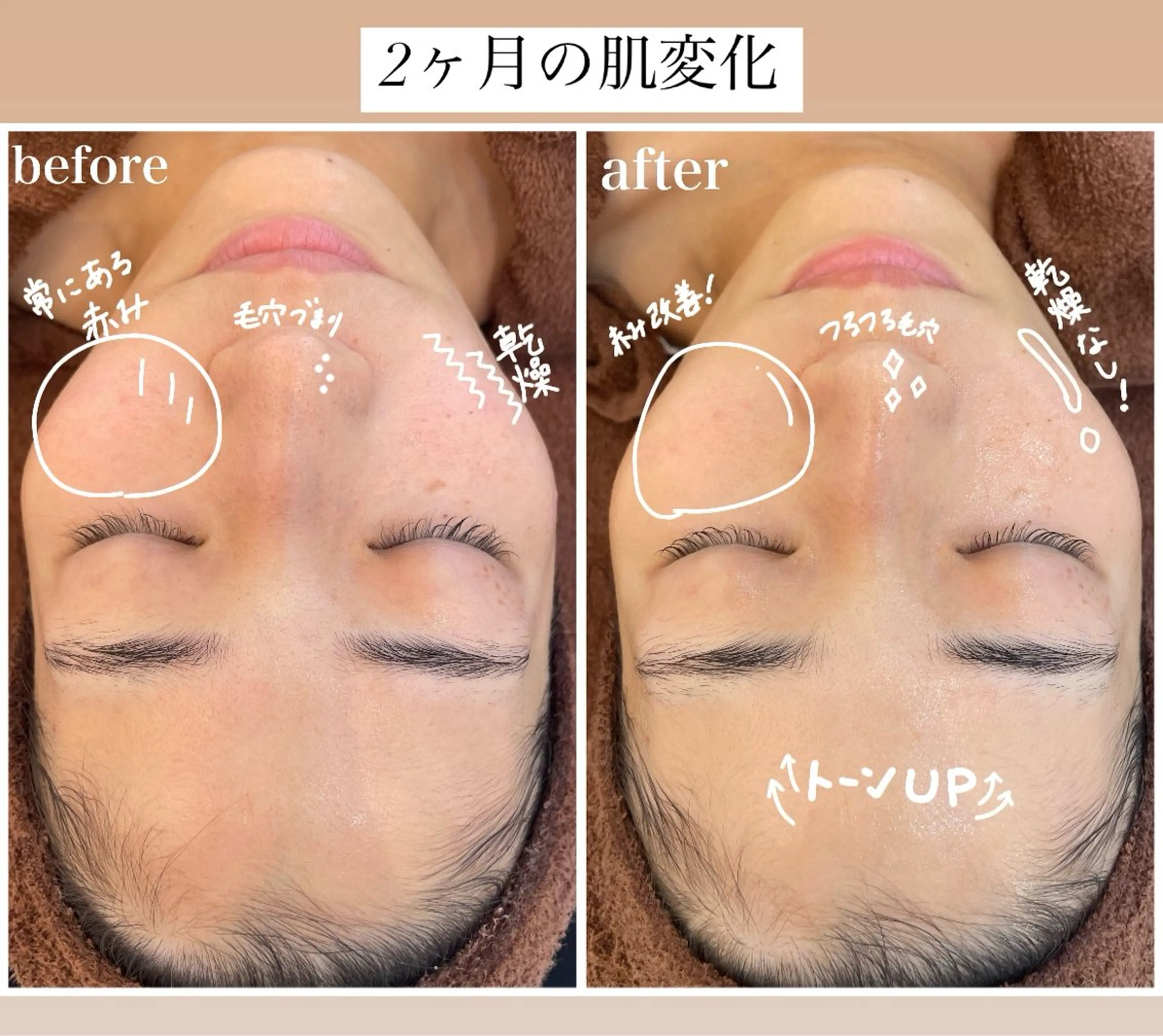 エステ リラク パーソナル肌質改善 🦋APRI🅿️有のエステ・リラクイメージ