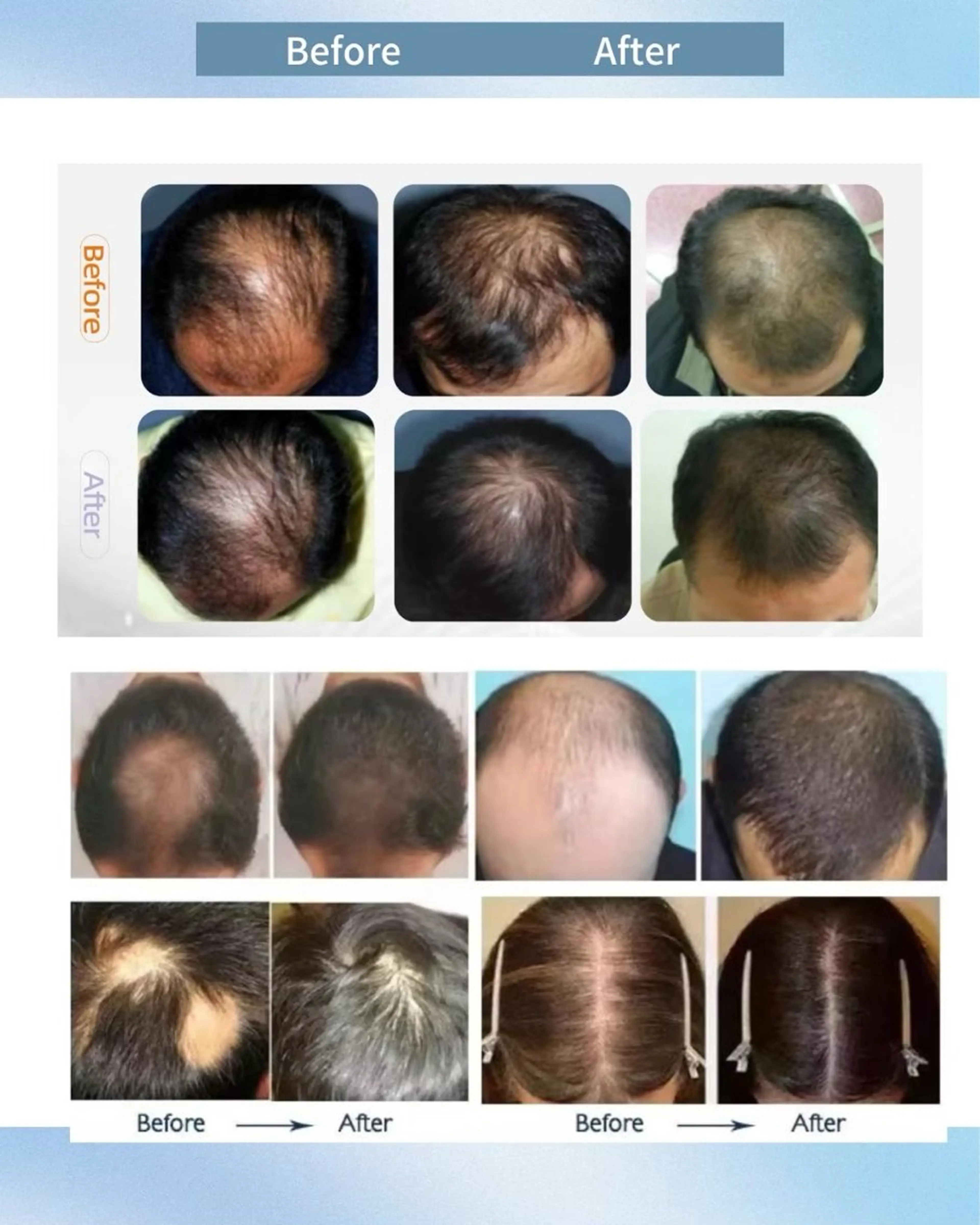 エステ セルフエステ ALL in ONE所属・1組貸切 セルフエステのエステ・リラクイメージ