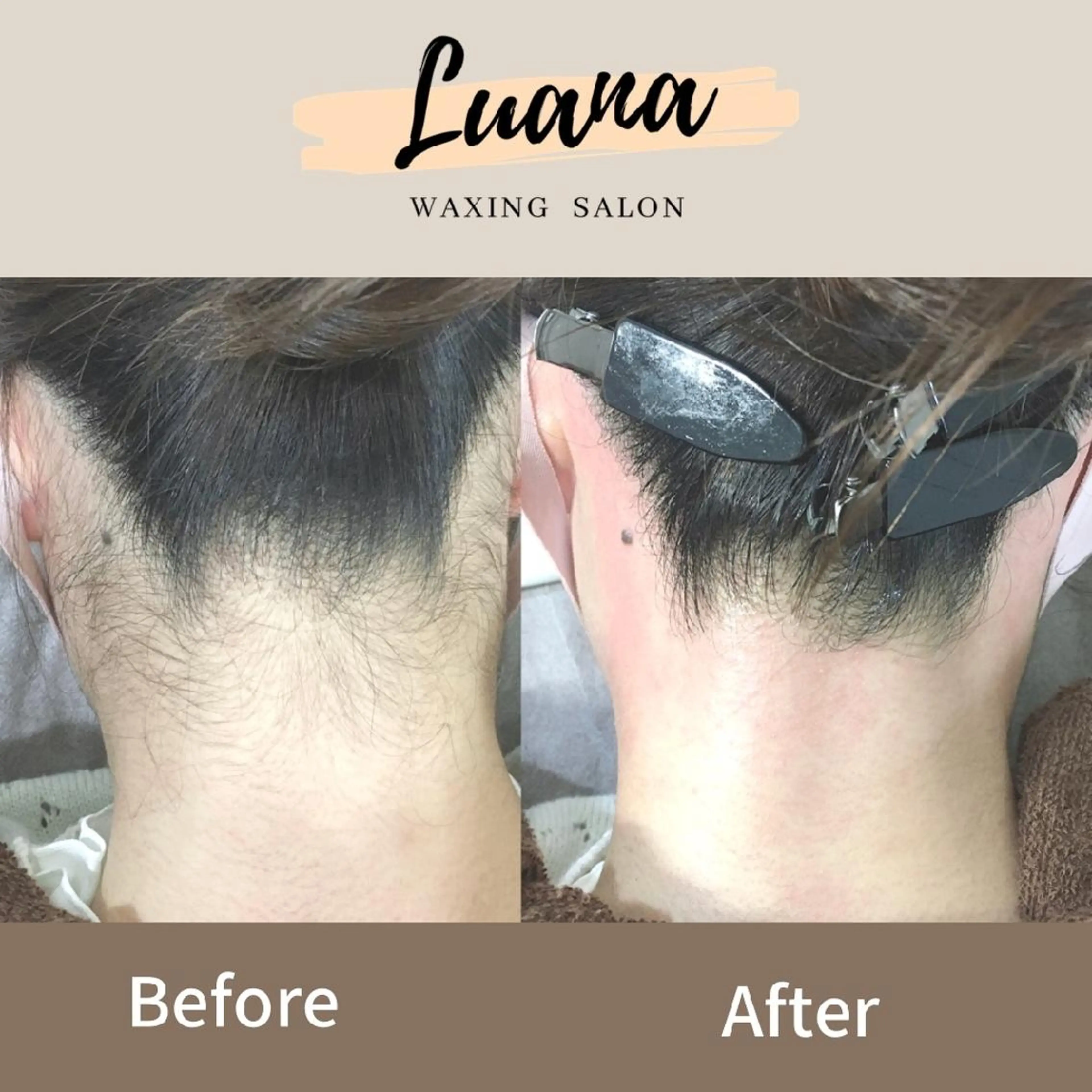 脱毛 Luana waxing salon所属・Luana wax 🐚根本のエステ・リラクイメージ