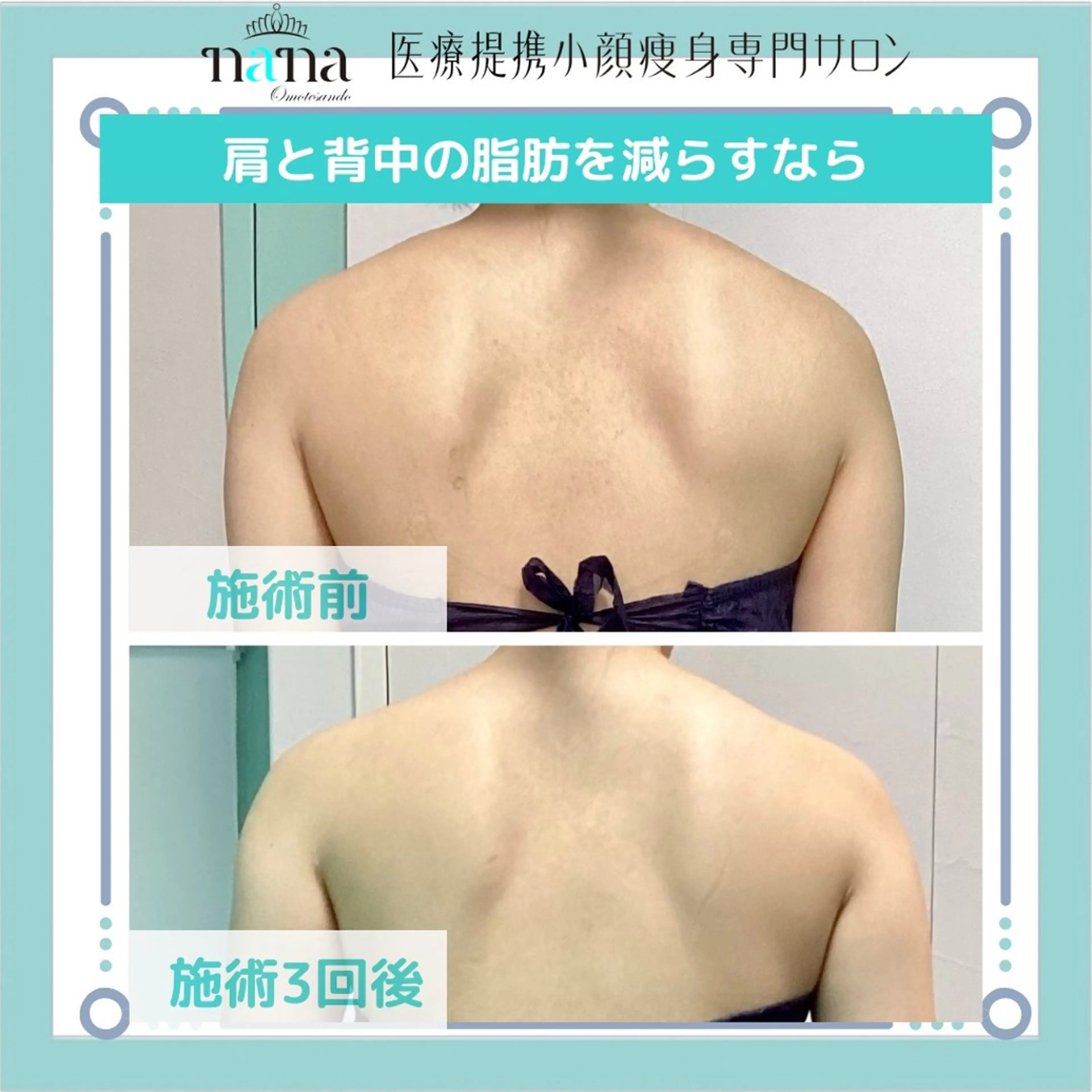 メンズ 小顔痩身インディバ Nana表参道のエステ・リラクイメージ