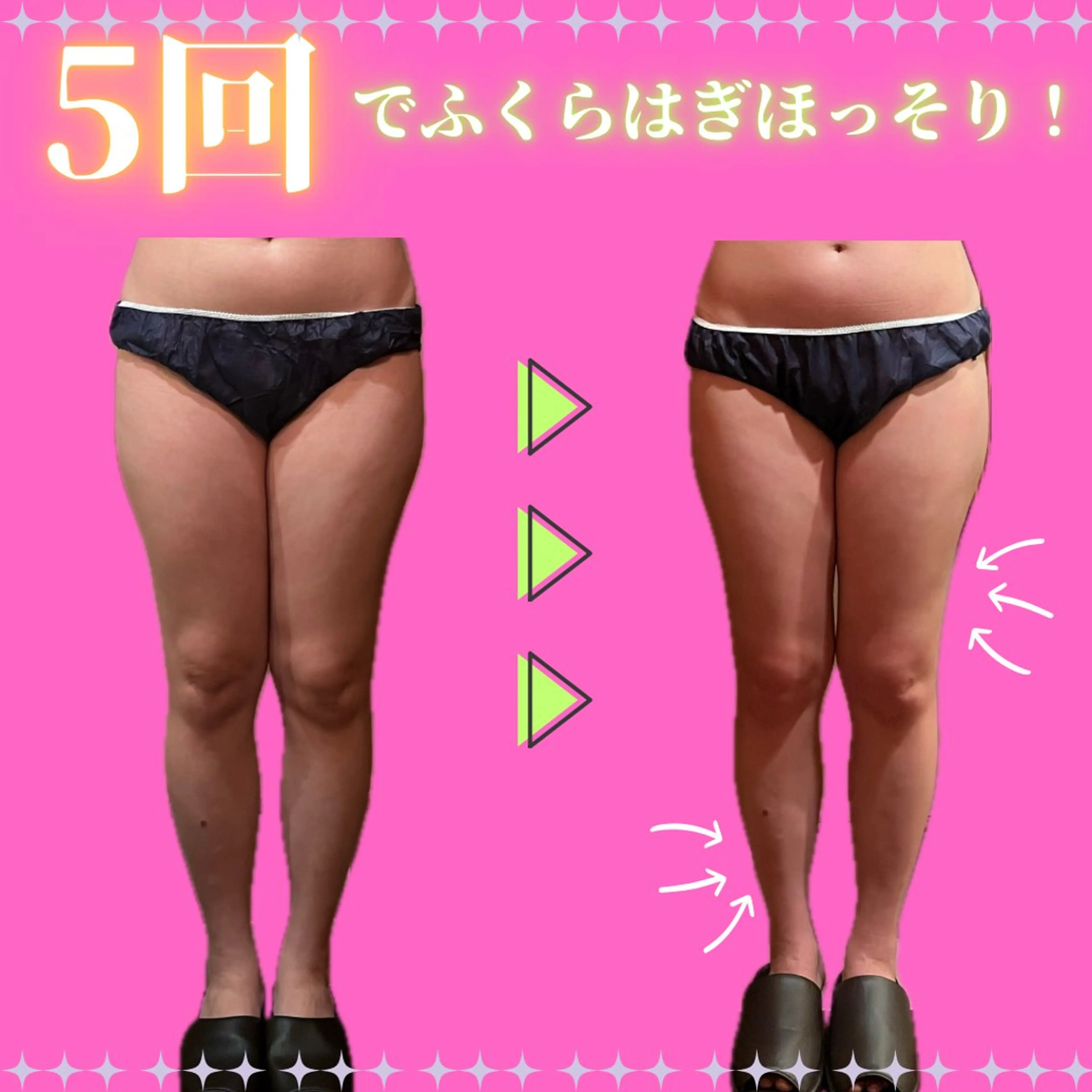 エステ 痩身&美肌サロン 堀米✨のエステ・リラクイメージ