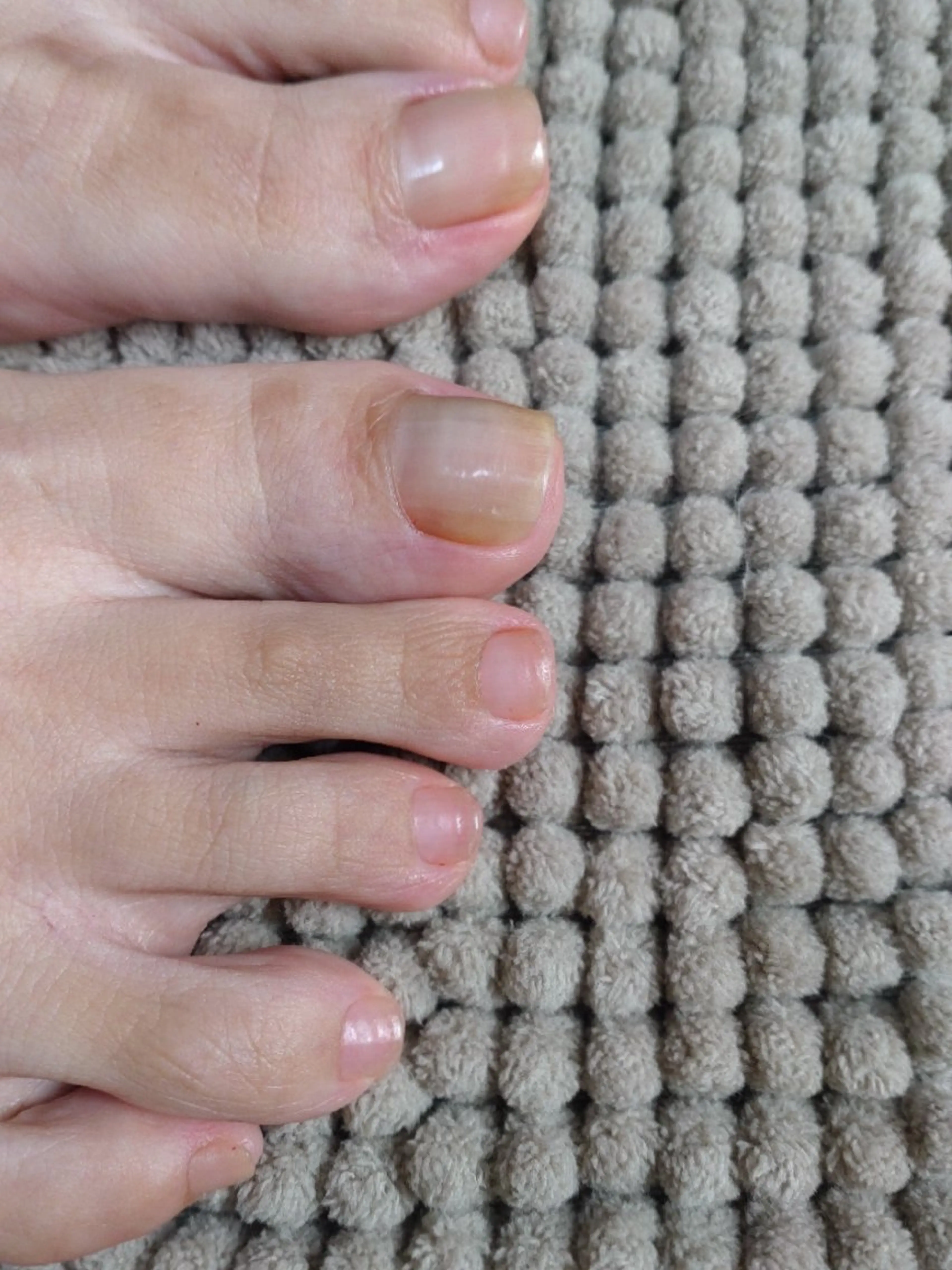 ネイル フットネイル その他(ネイル) norafu.所属・nail 　norafu.のネイルデザイン