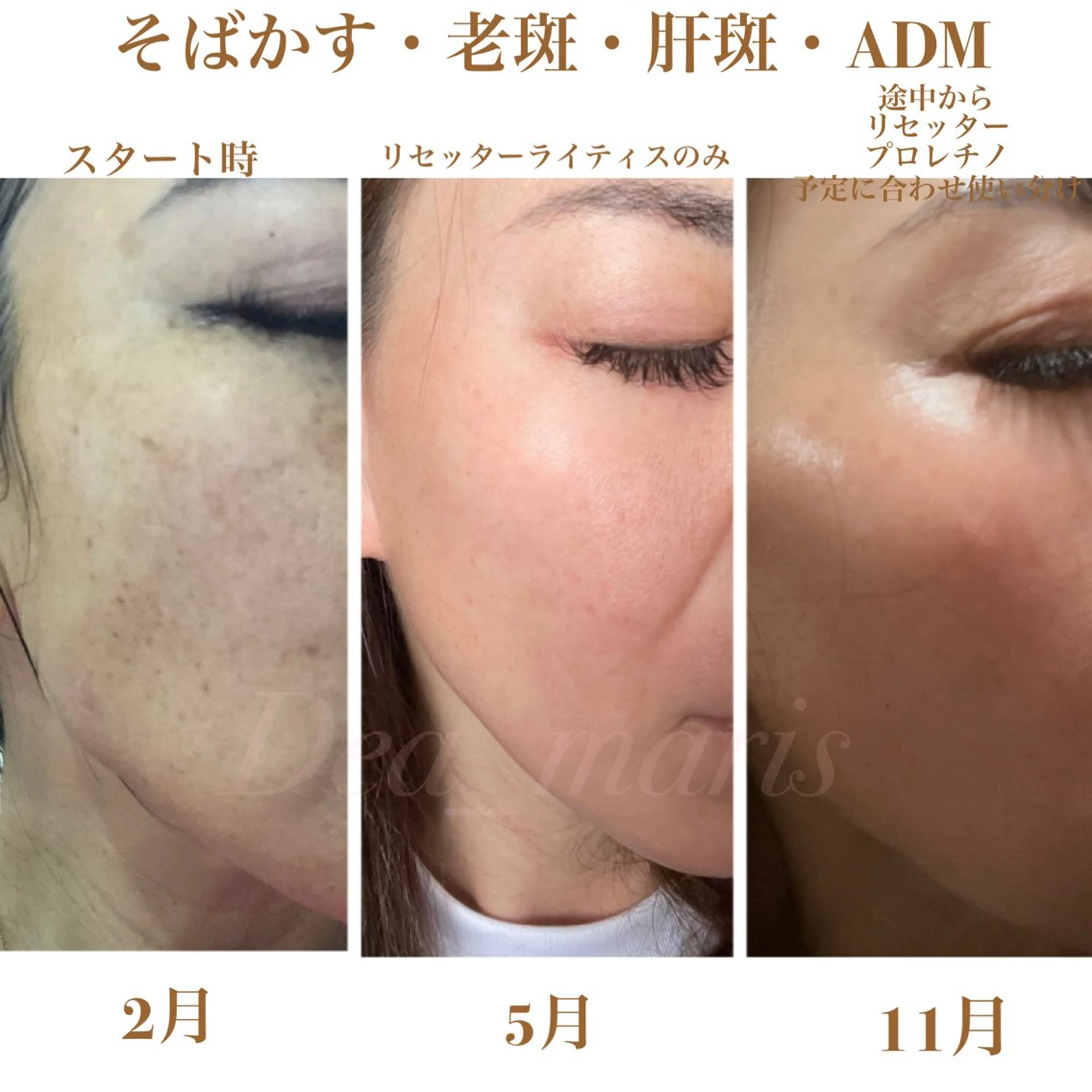 private salon  Dea_maris シュガーリング＆パーソナルボディケア所属・ダイエット難民が通う 10キロダイエットのエステ・リラクイメージ