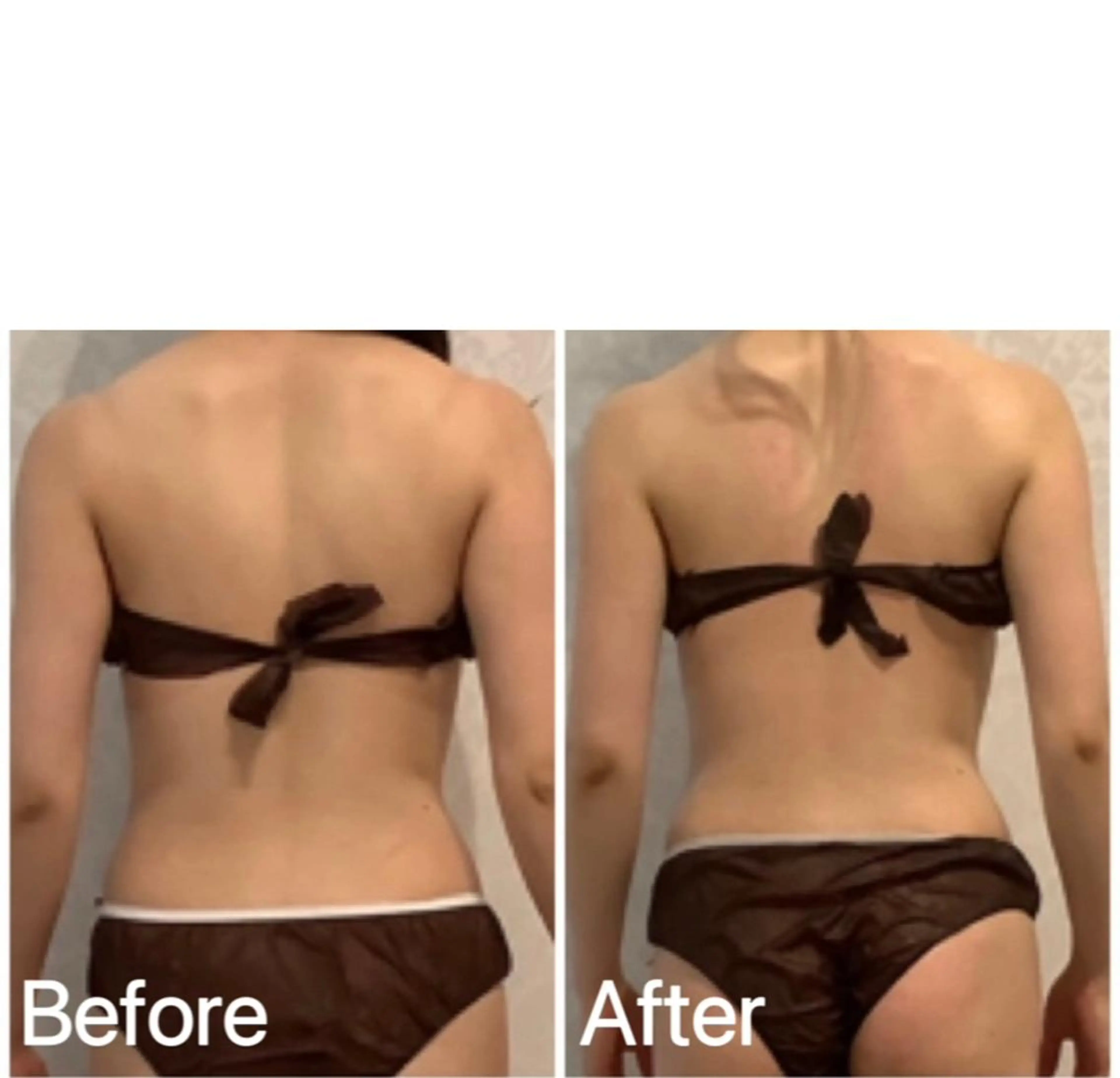 小顔痩身インディバ Nana表参道のエステ・リラクイメージ