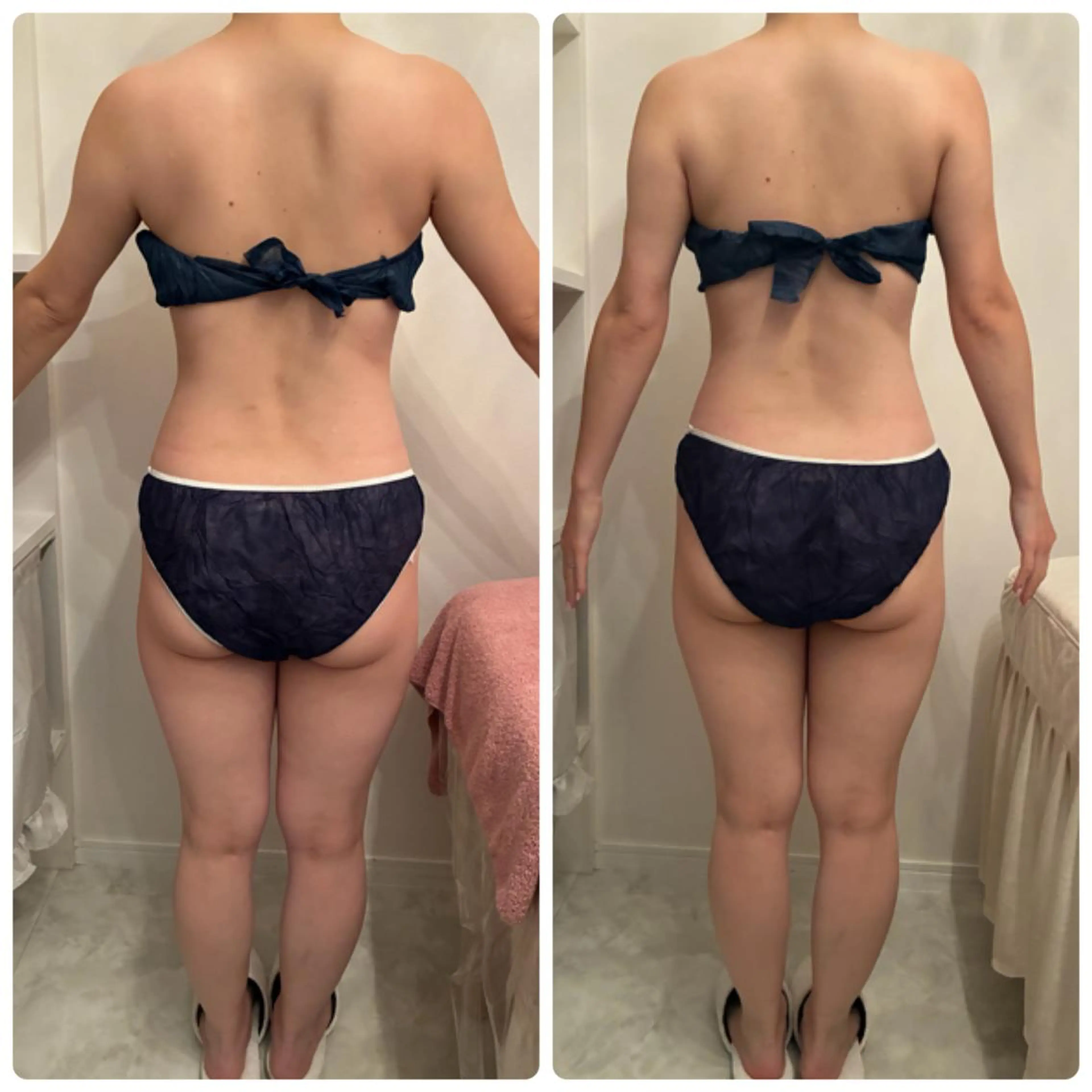 FLEUR🫧 フェイシャルのエステ・リラクイメージ