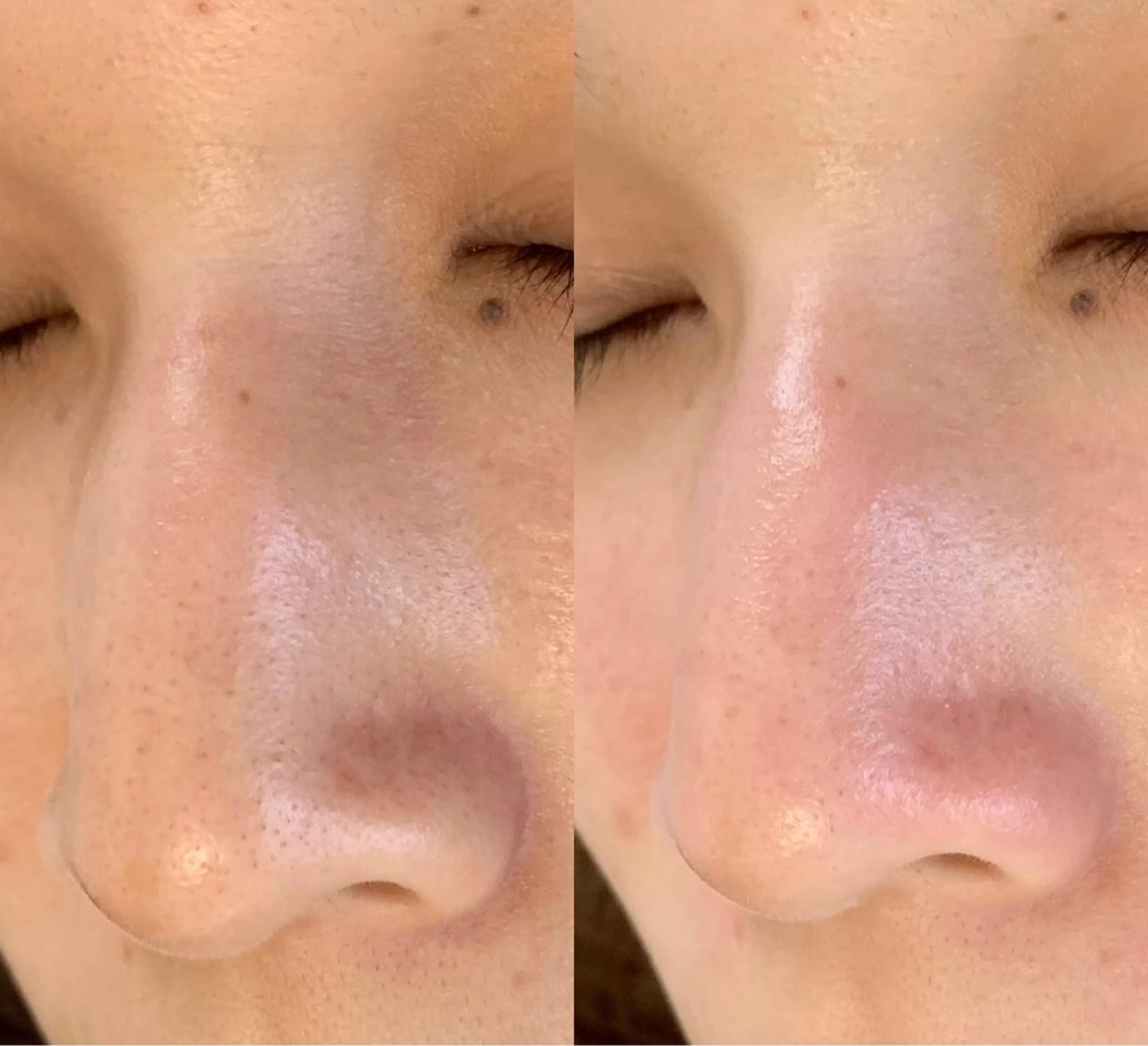 メンズ エステ salonLADYSTYLE所属・稲嶺 美華のエステ・リラクイメージ