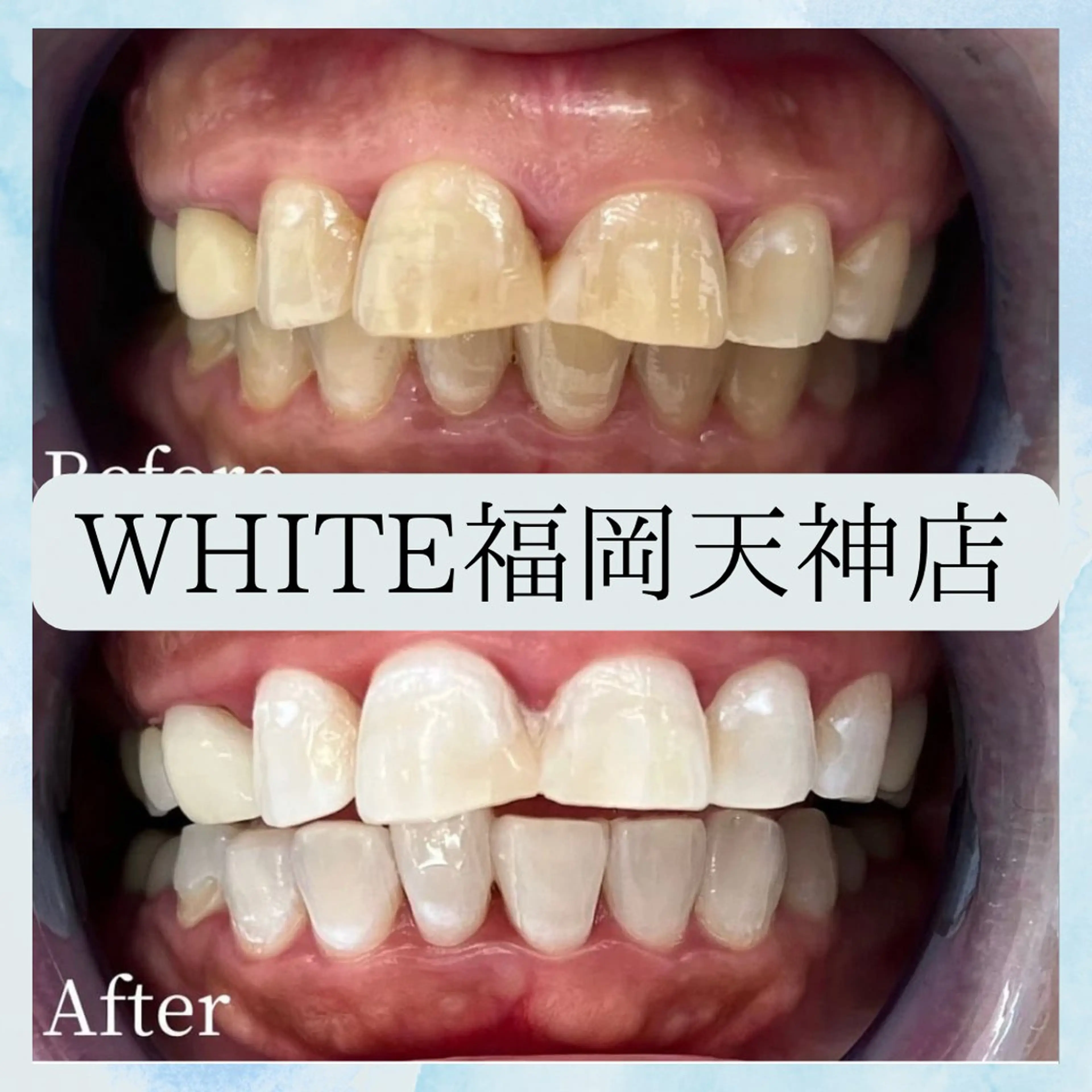 メンズ 撮影モデル ホワイトニング専門店 WHITE天神店のエステ・リラクイメージ