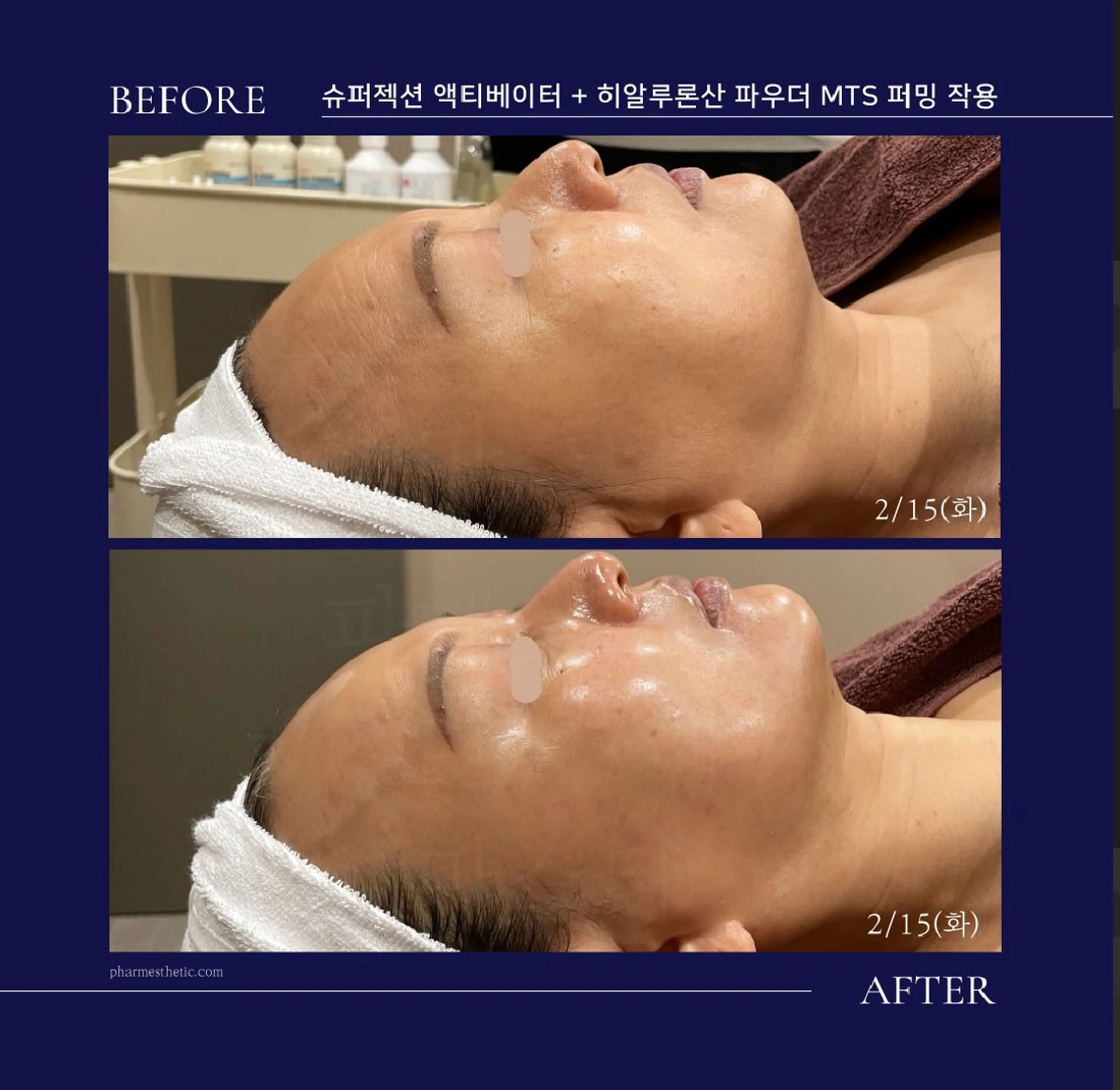 Honey Moom所属・Honey Moomのエステ・リラクイメージ