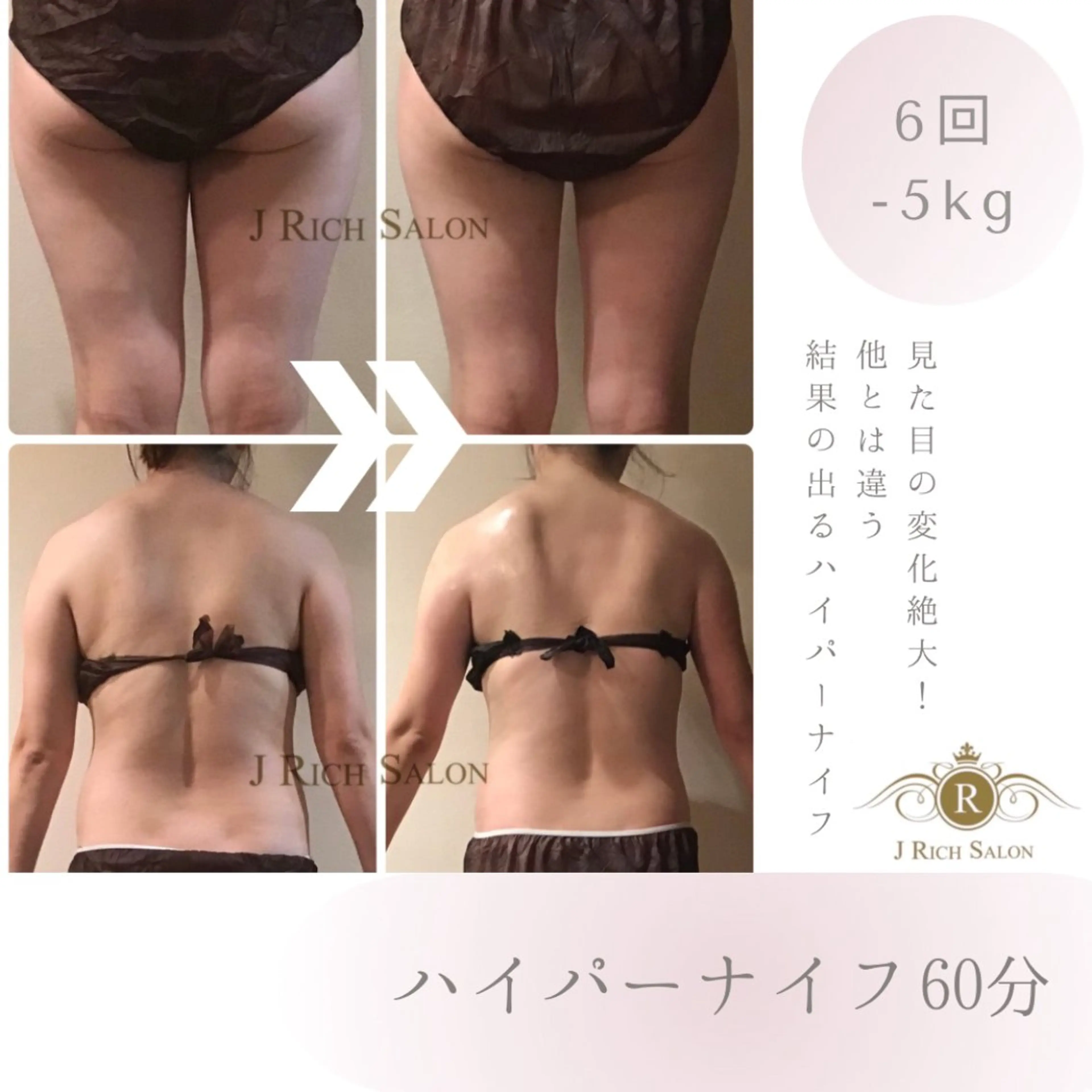 エステ ジェイリッチサロン 体質改善・韓国肌管理のエステ・リラクイメージ