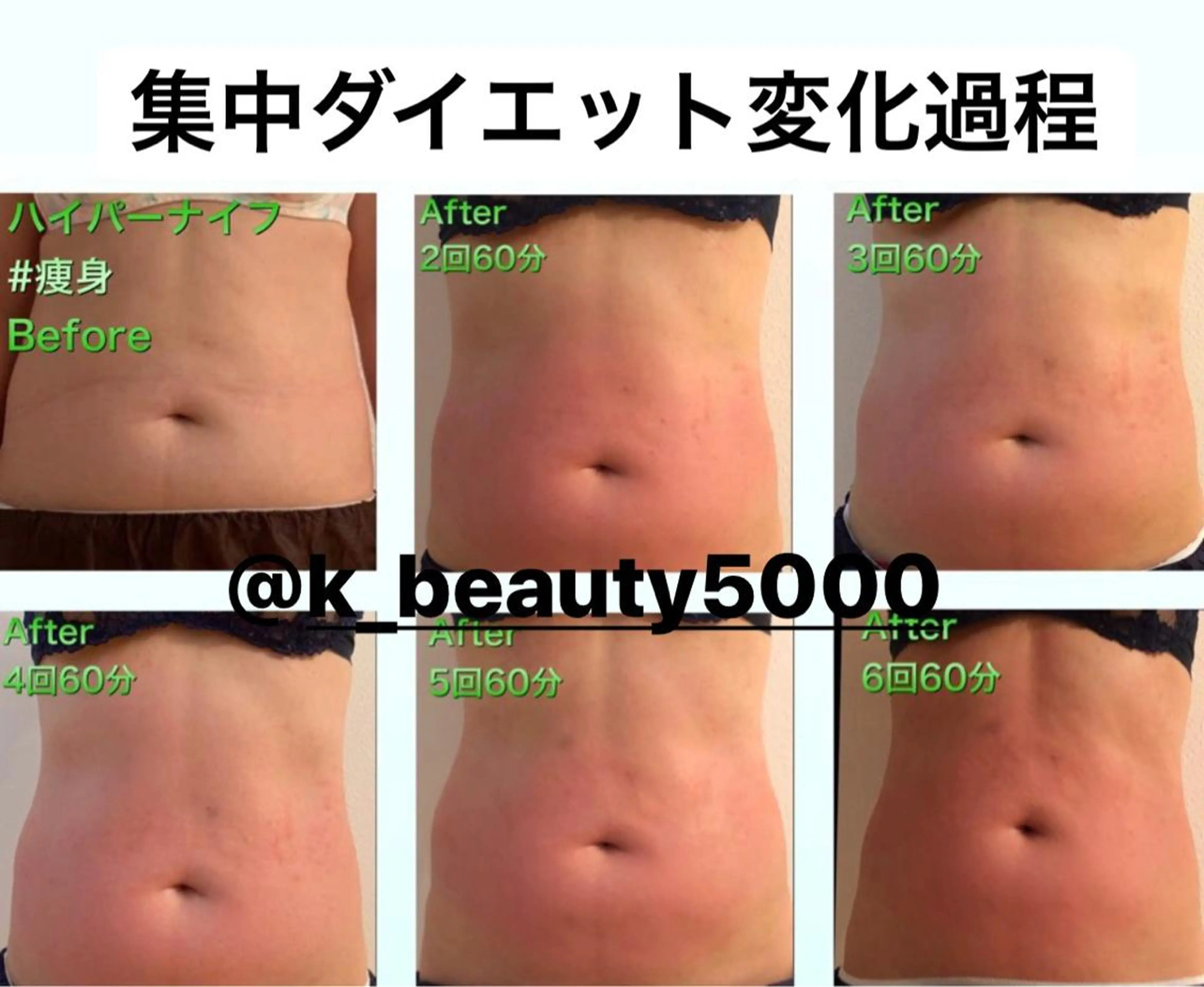 エステ リラク 【ハイパーナイフ痩身&小顔コルギ&ハーブピーリング】K-Beauty　東新宿所属・kーbeauty痩身 フェイシャルのエステ・リラクイメージ