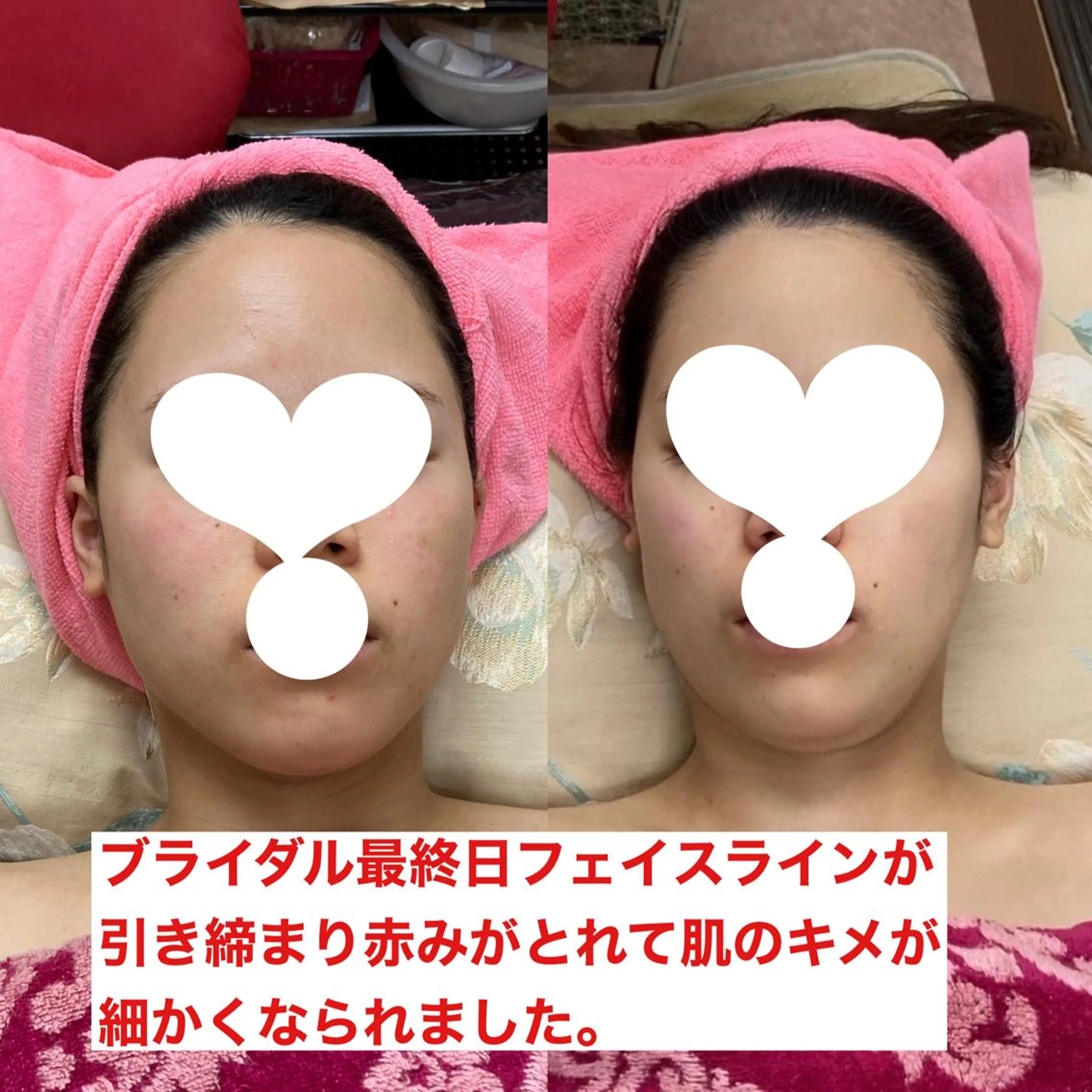 オアシス・さくら所属・中村貴子都度払い脱毛 小顔コルギのエステ・リラクイメージ