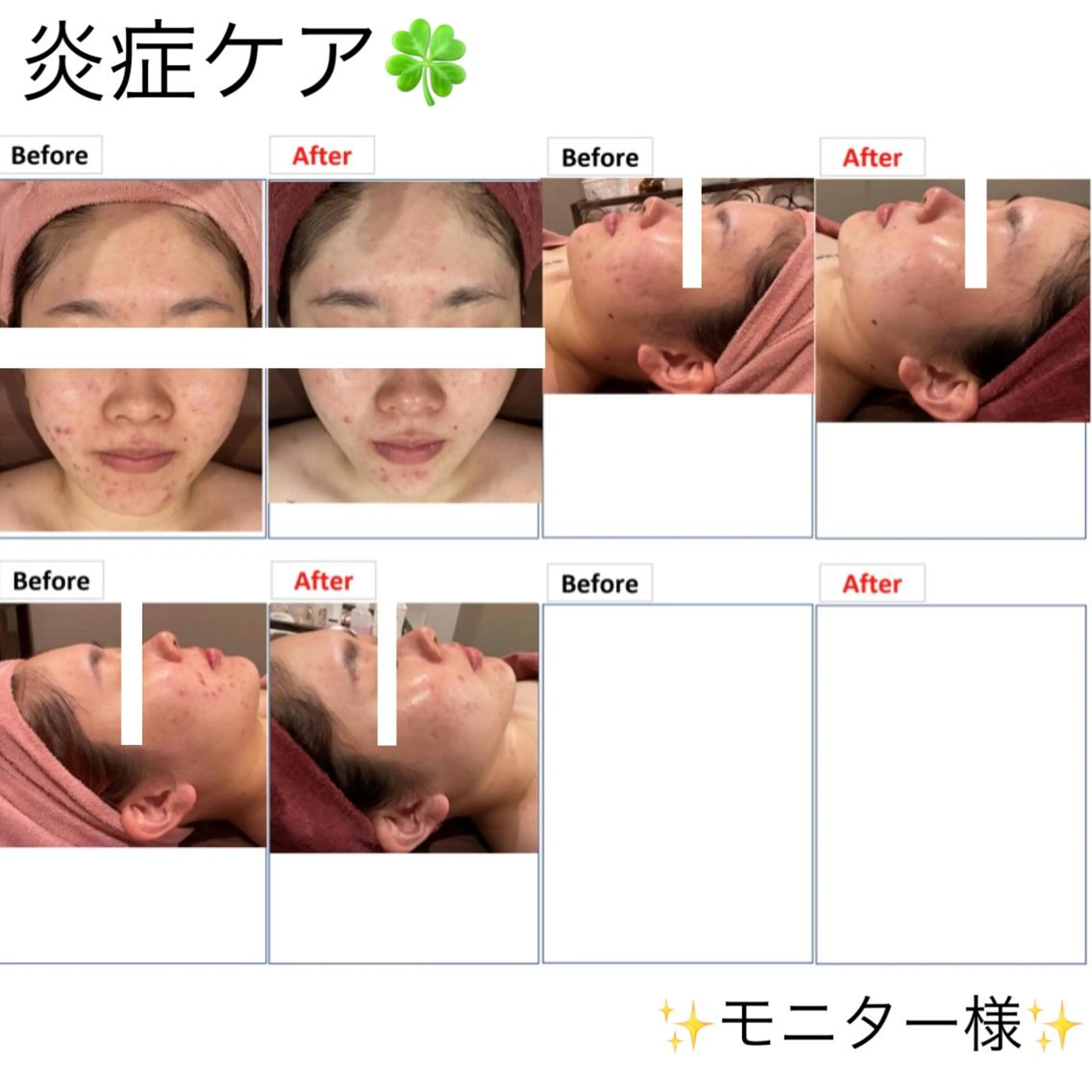 レイビス 渋谷店のエステ・リラクイメージ