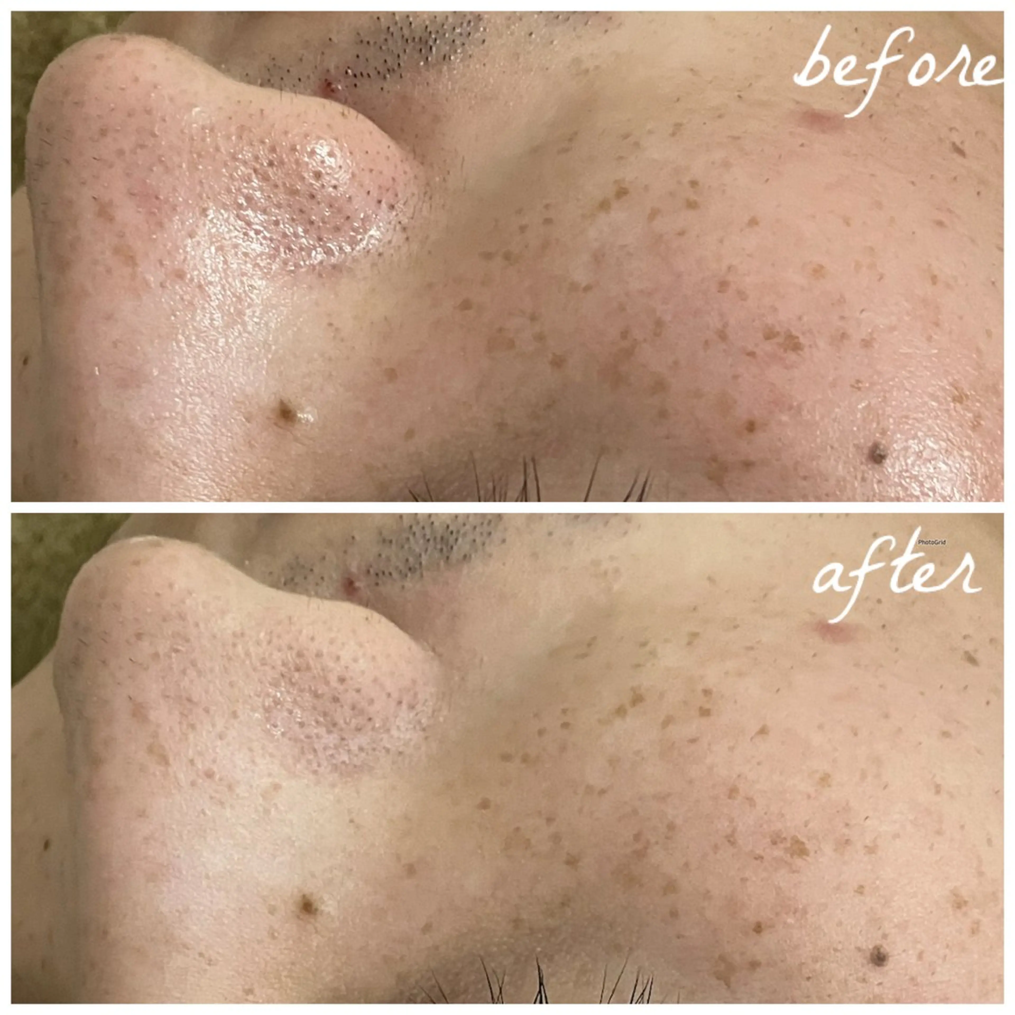 メンズ エステ メナード岐阜茜部 杉浦のエステ・リラクイメージ