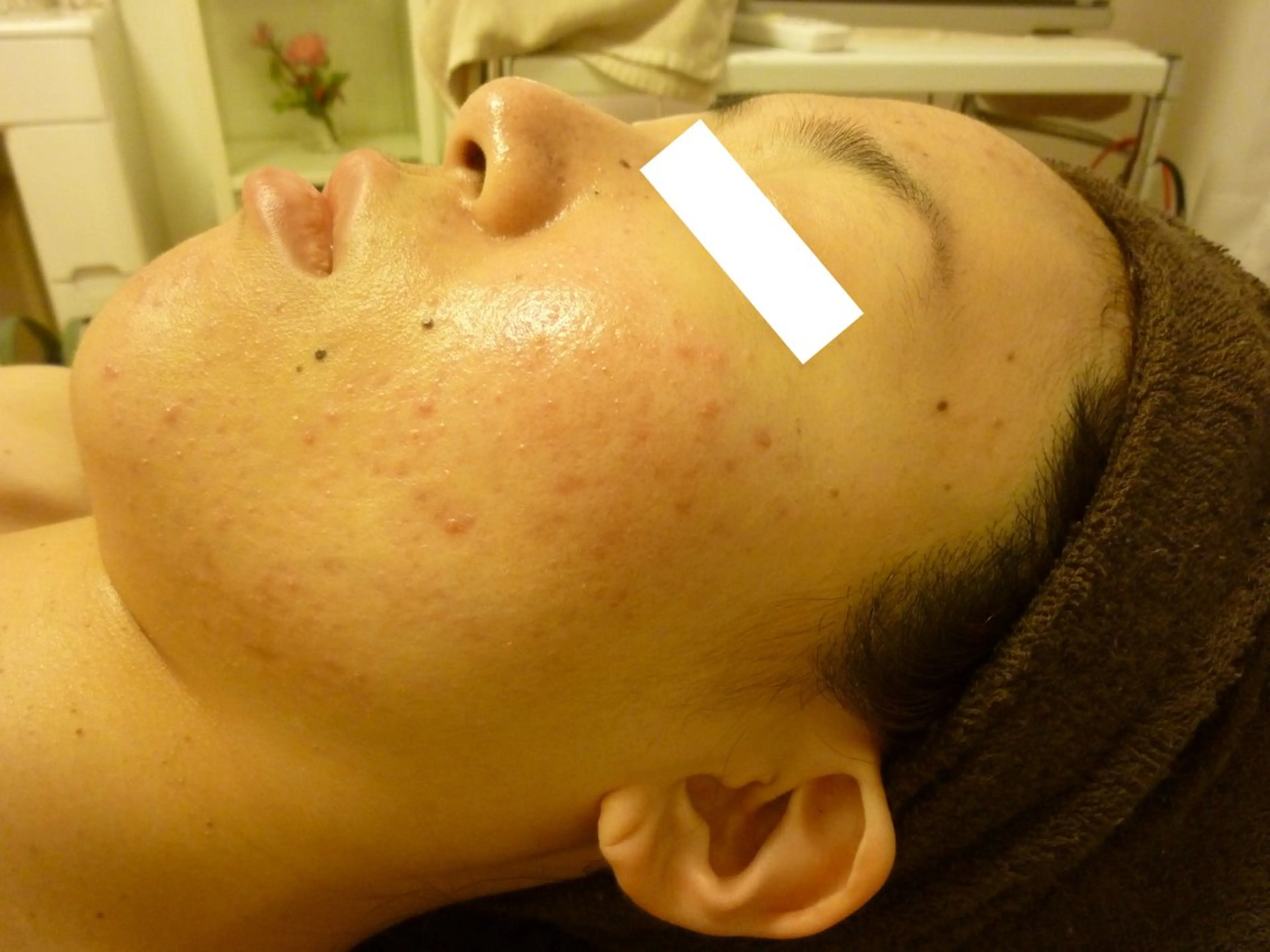 ピーリングサロン シャンテール所属・ピーリングサロン シャンテールのエステ・リラクイメージ