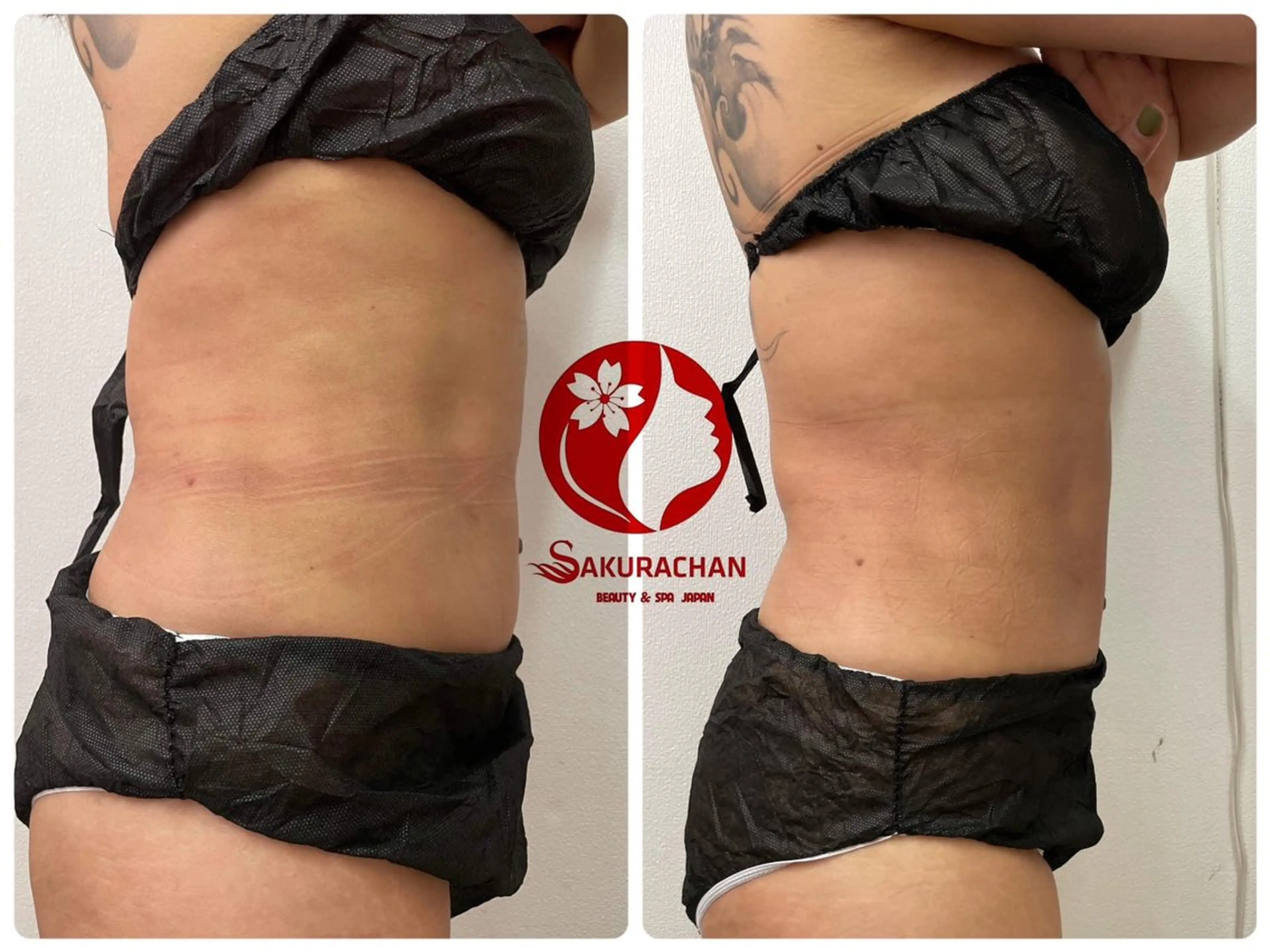 ニキビ、痩身、脱毛、 サクラチャンスパのエステ・リラクイメージ