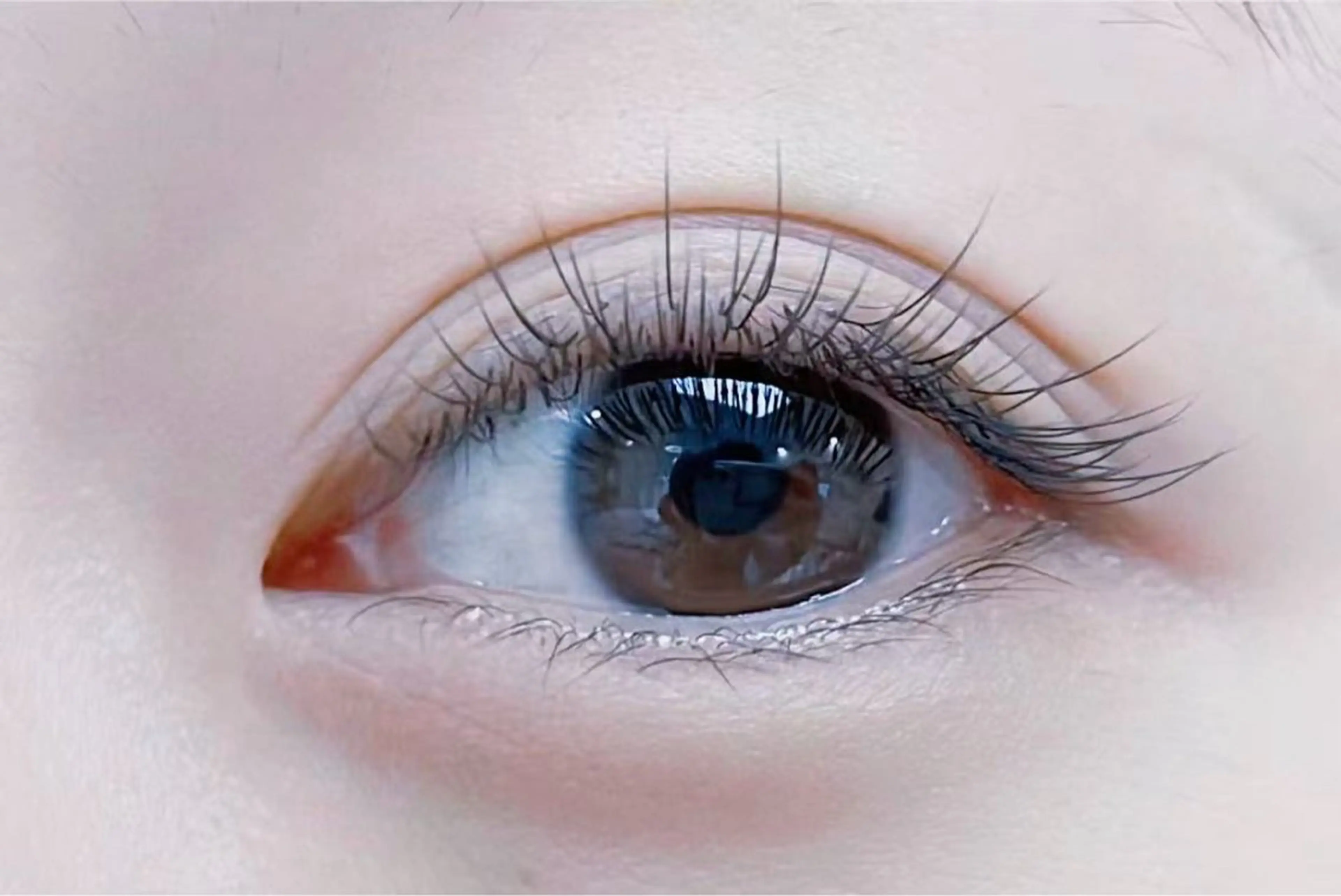 フラットラッシュ　100本の写真