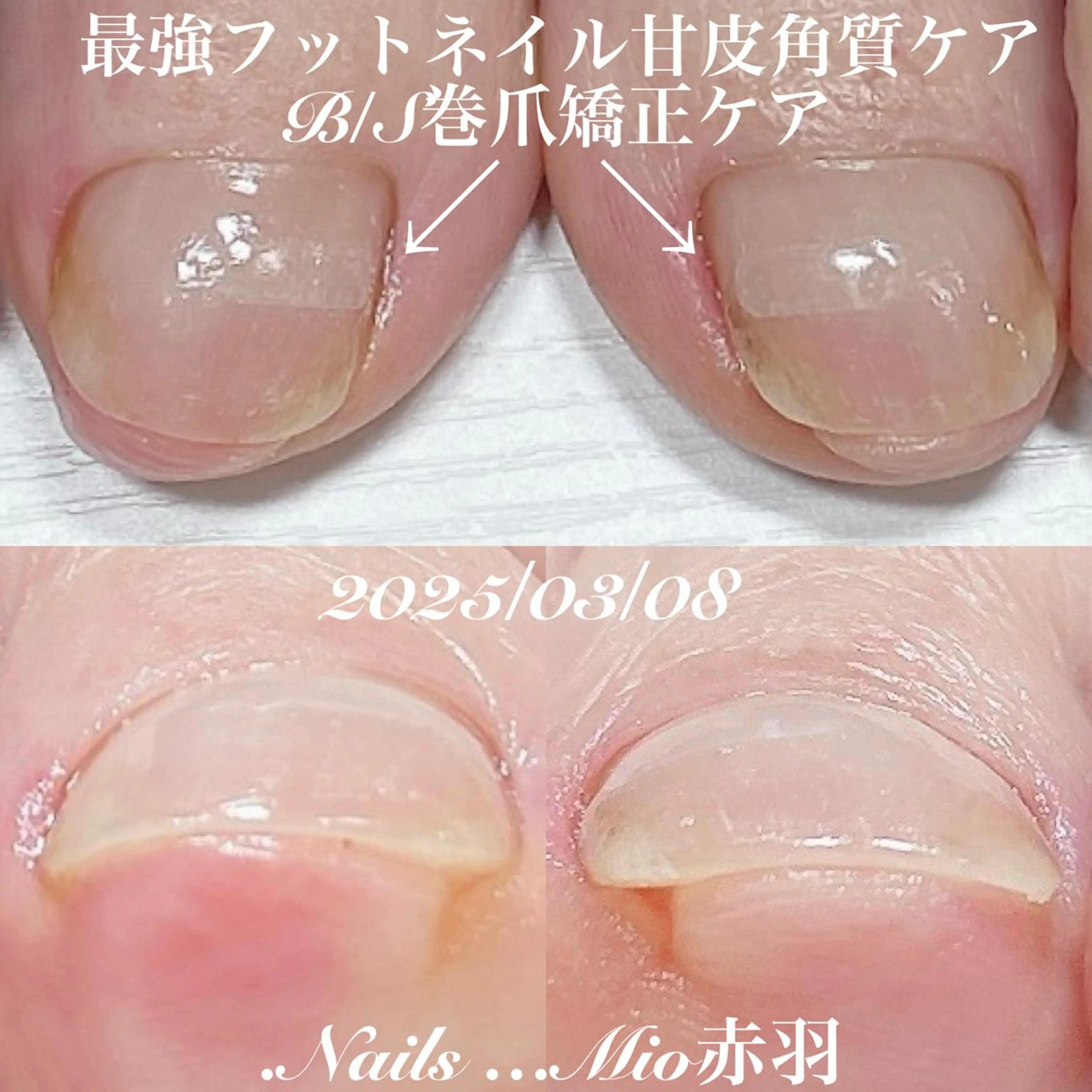 ネイル フットネイル 赤色 .Nails Mio 赤羽西ネイルサロンのネイルデザイン