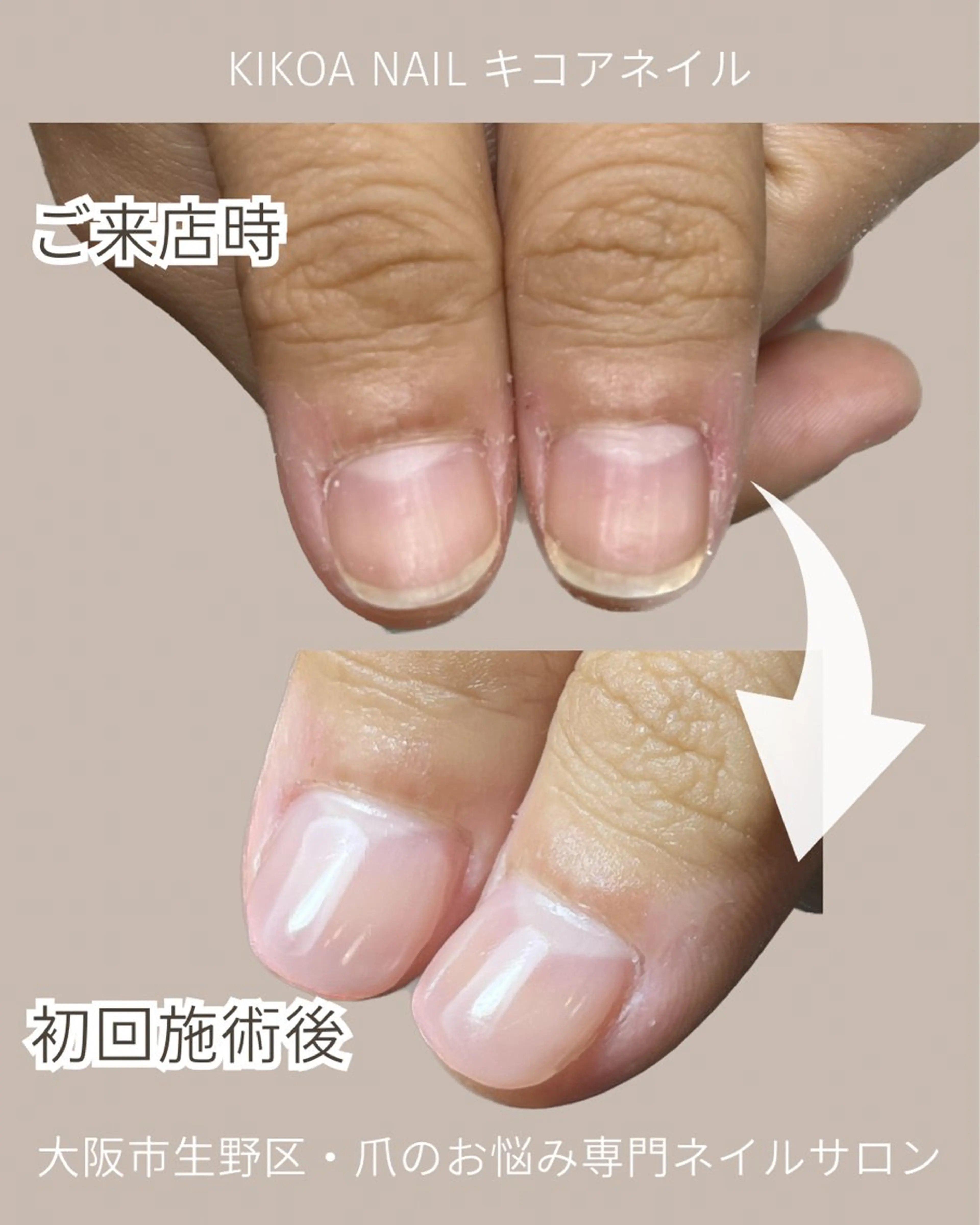 ネイル ピンク KIKOA NAIL キコアネイルのネイルデザイン