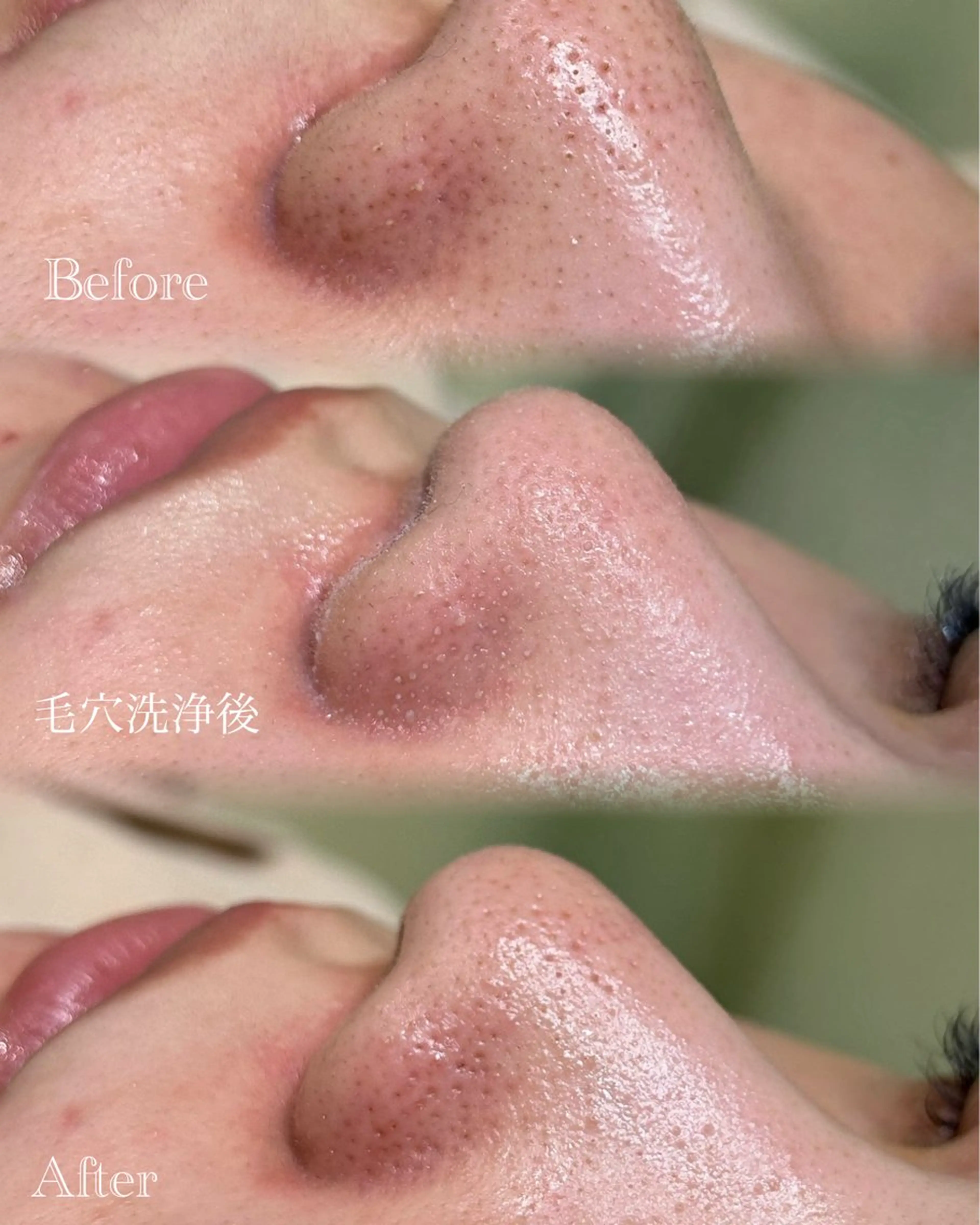 その他 🫧美しい素肌へ🫧 今成柚乃のその他イメージ