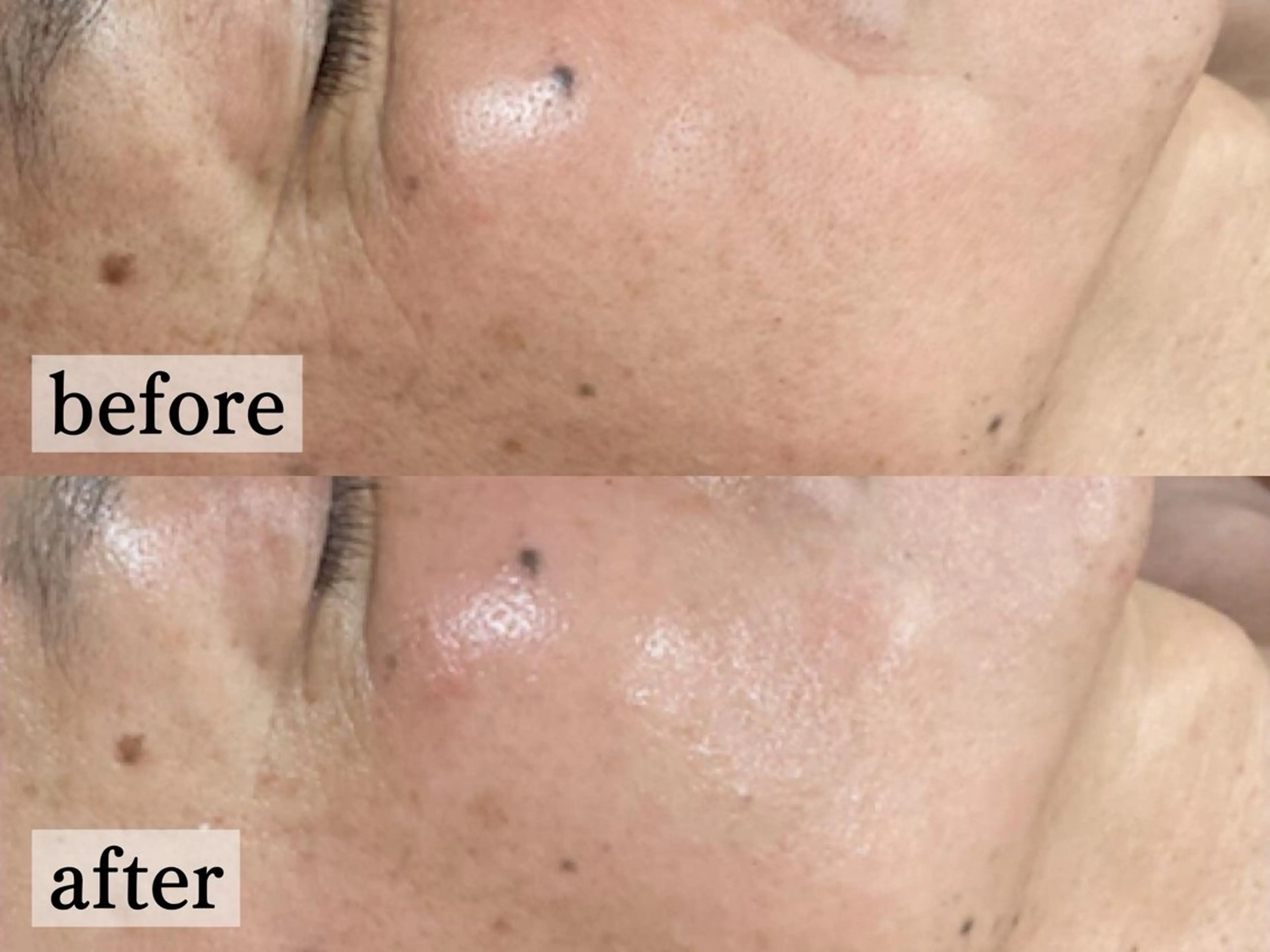 エステ フェイシャル/脱毛 ジョアアンジェ竹田のエステ・リラクイメージ