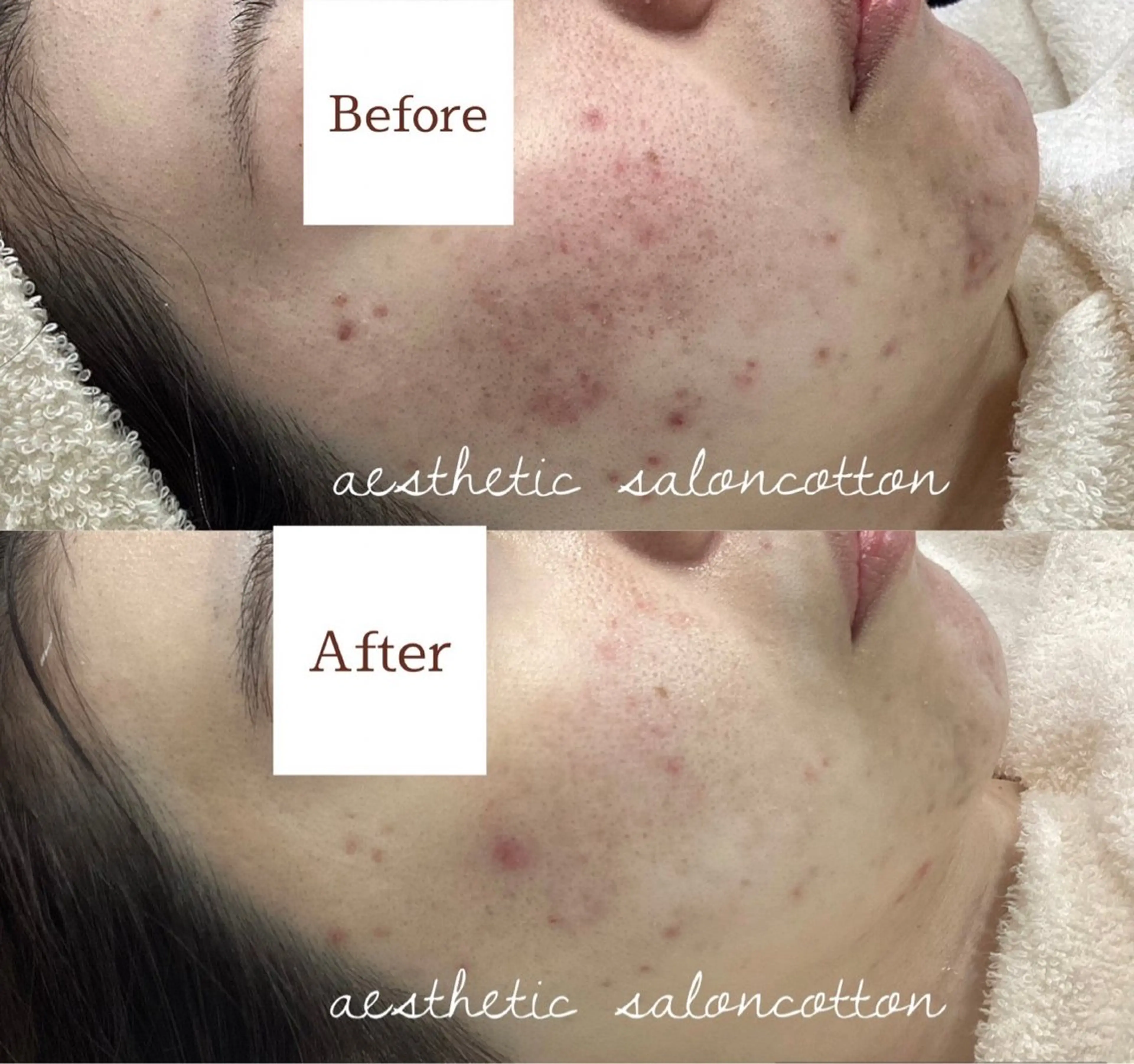 エステ 都度払い 肌質改善専門サロンのエステ・リラクイメージ