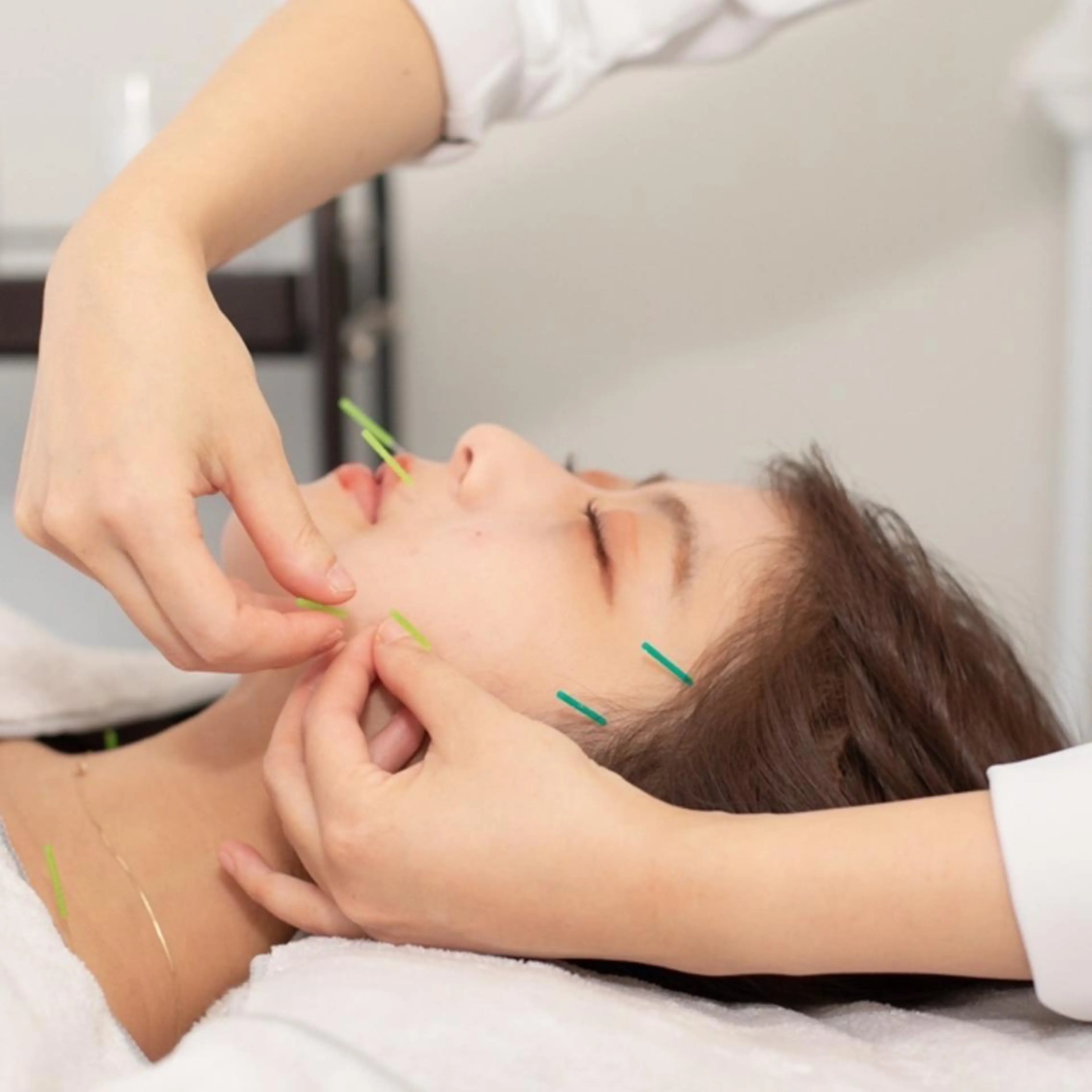 新宿hari-me所属・美容鍼hari-me 新宿のエステ・リラクイメージ