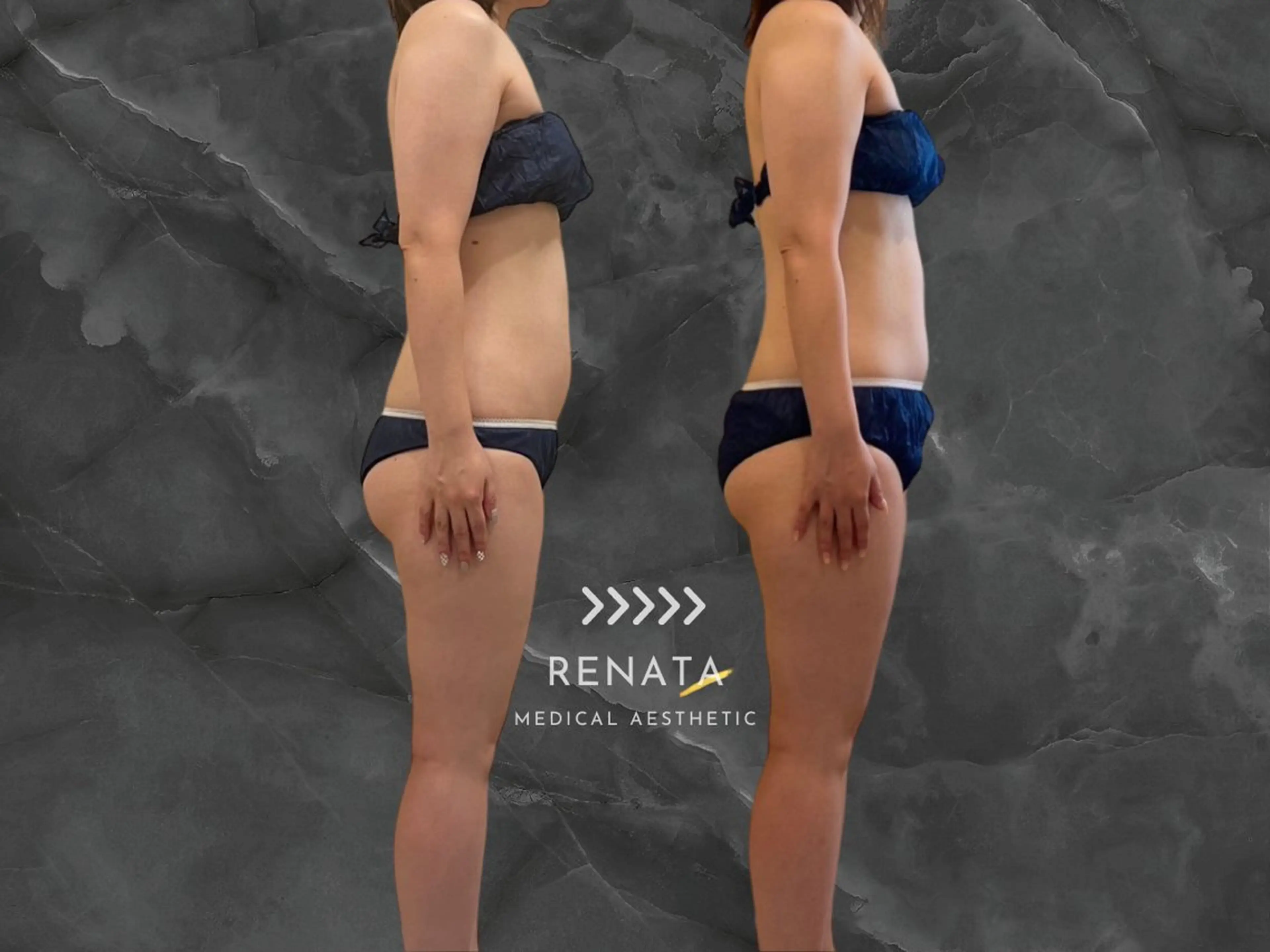 RENATA🕊 脂肪冷却専門店六本木のエステ・リラクイメージ