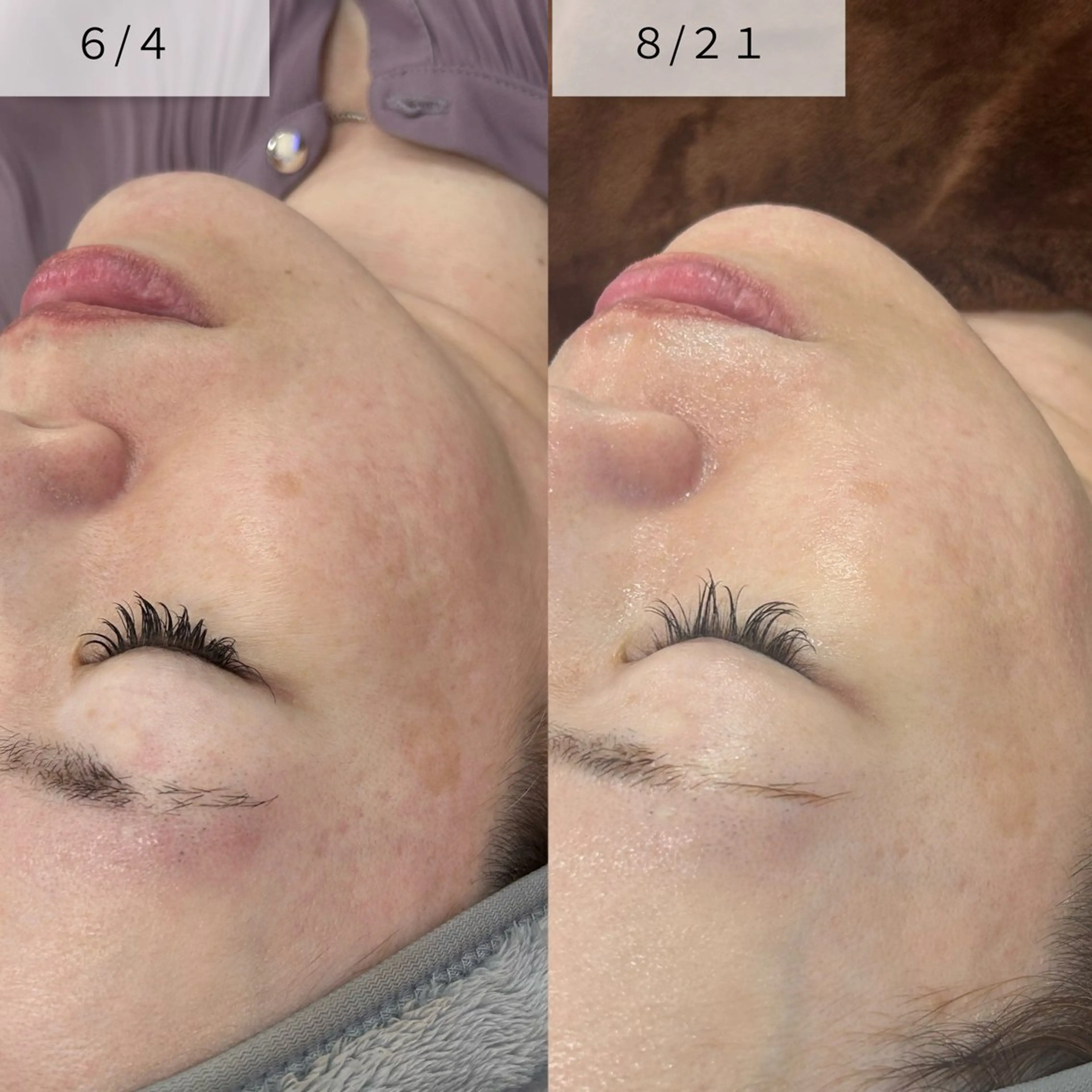 エステ Venus所属・エステサロン Venusのその他イメージ