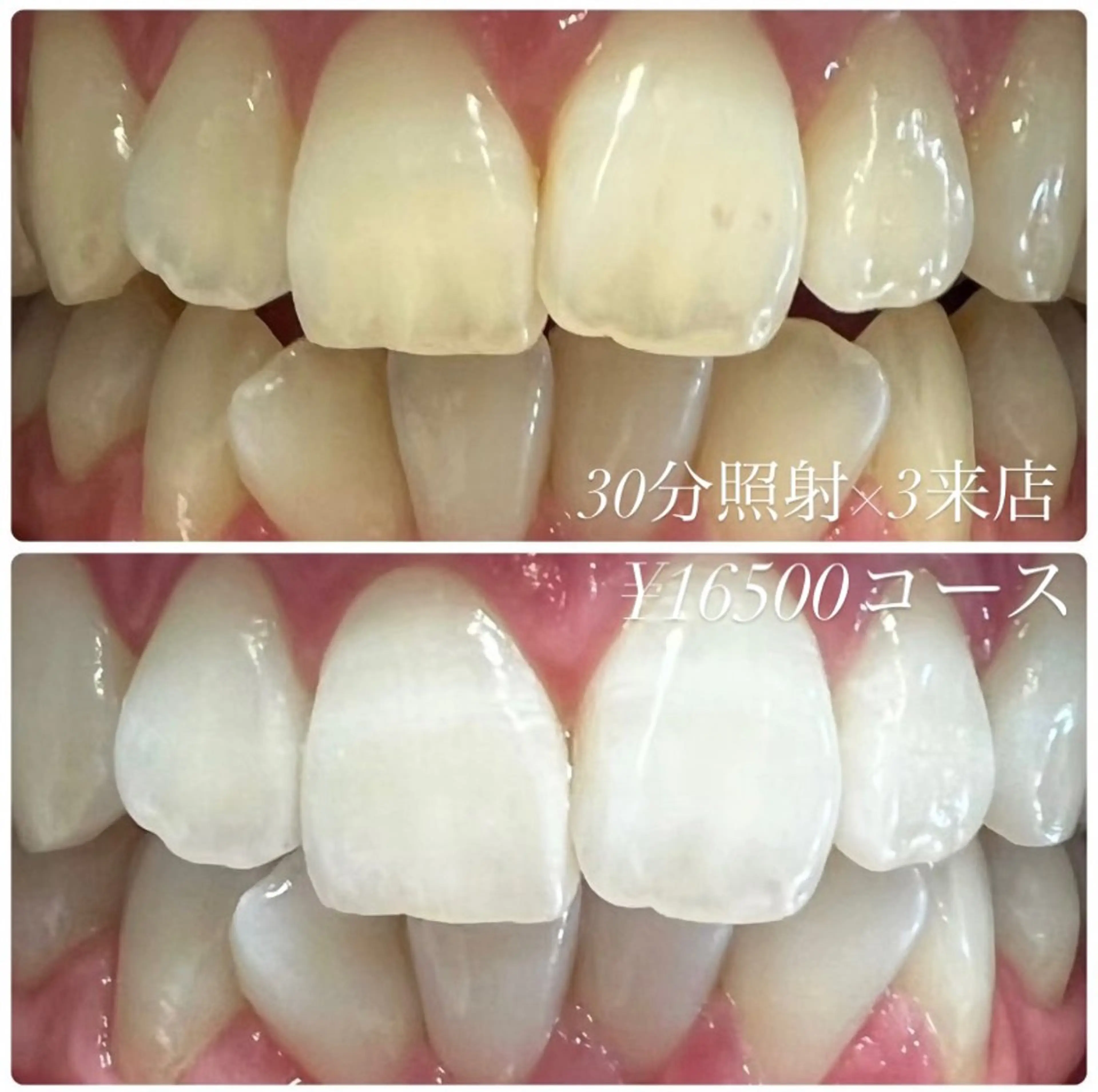 その他 ホワイトニングルーム 川崎店所属・ホワイトニング ルーム 川崎店のその他イメージ