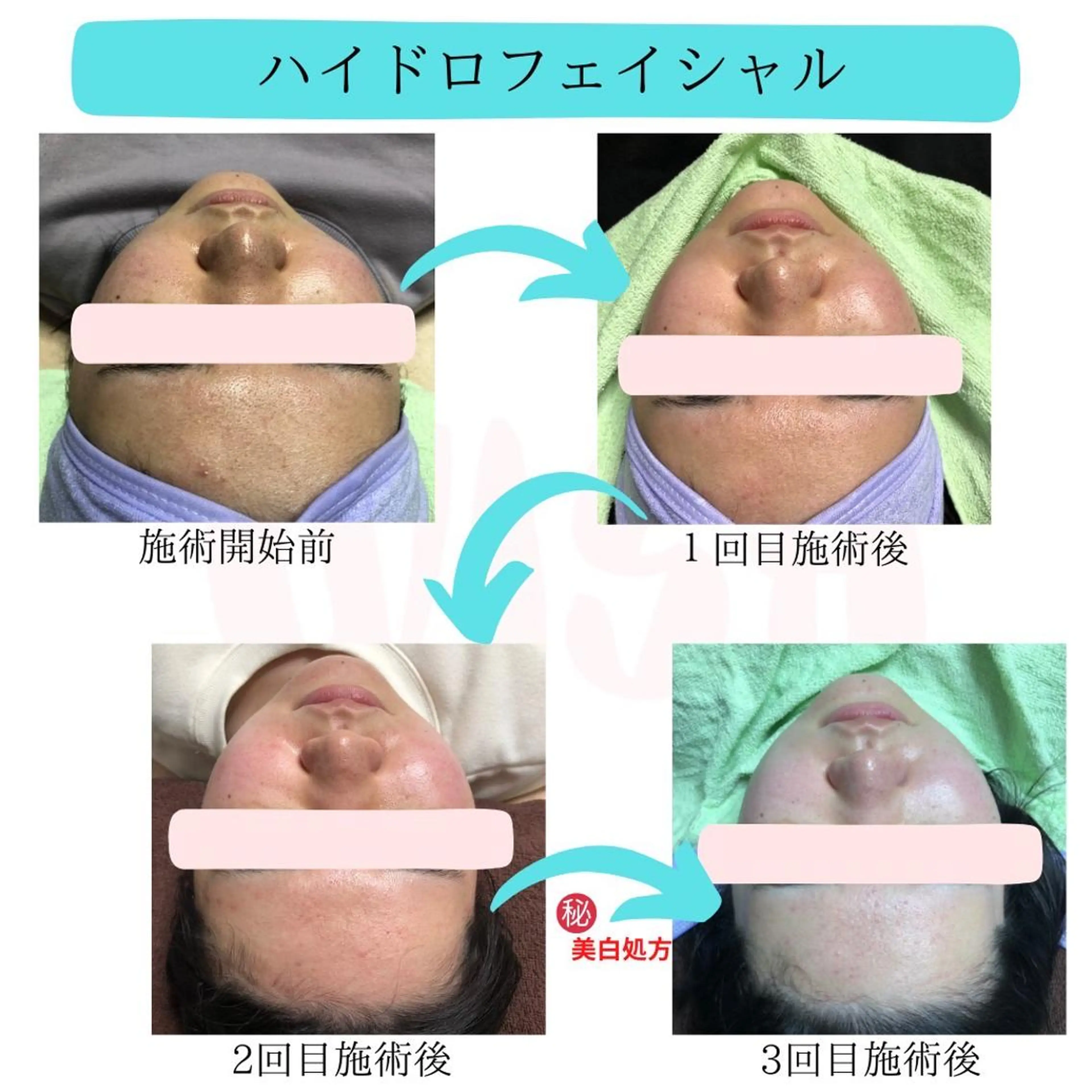 マツエク・マツパ アイブロウ 韓国風マツエク WISH 美肌脱毛のプロ！須藤のエステ・リラクイメージ