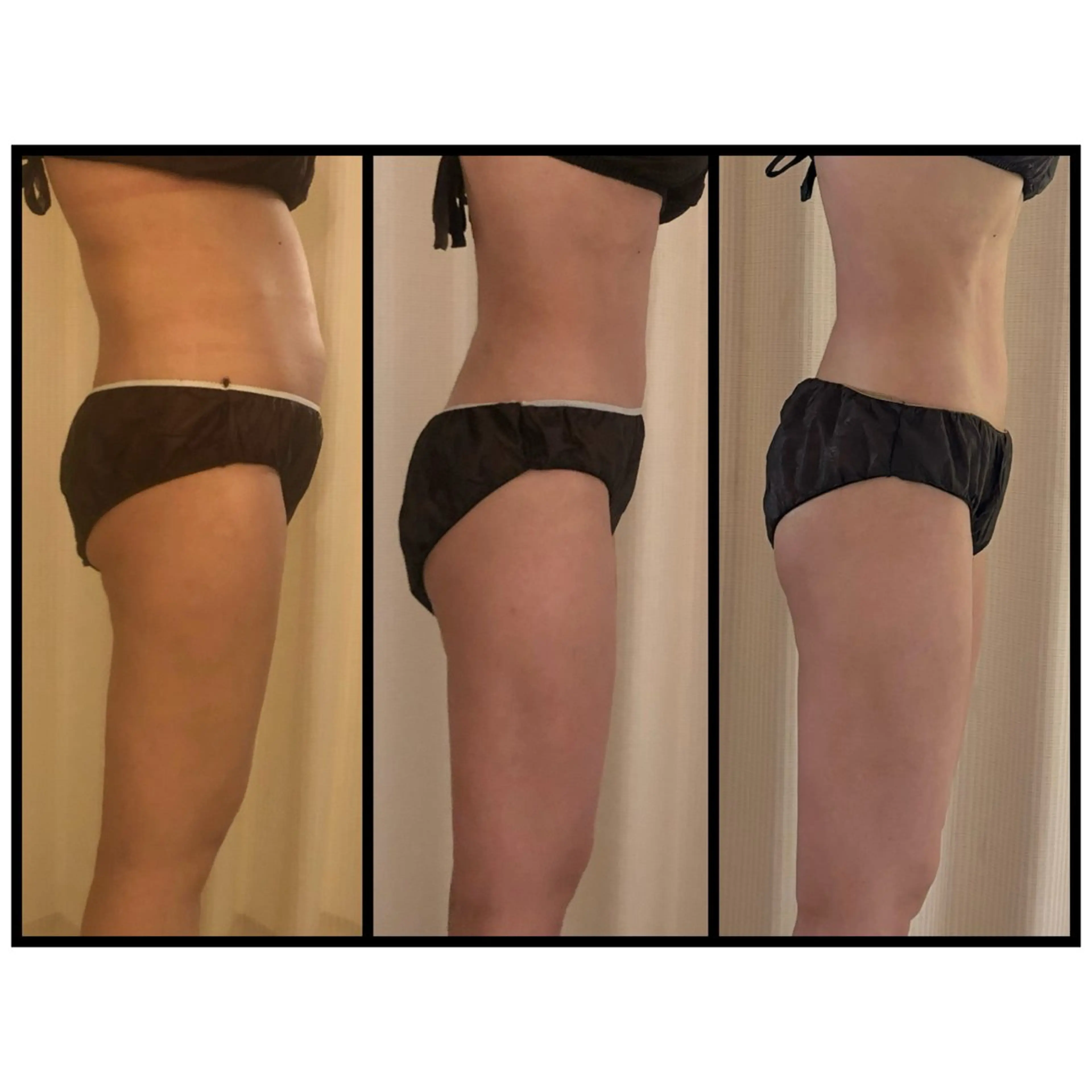 エステ リラク 【痩身】インドエステ ＆筋膜リリースのエステ・リラクイメージ