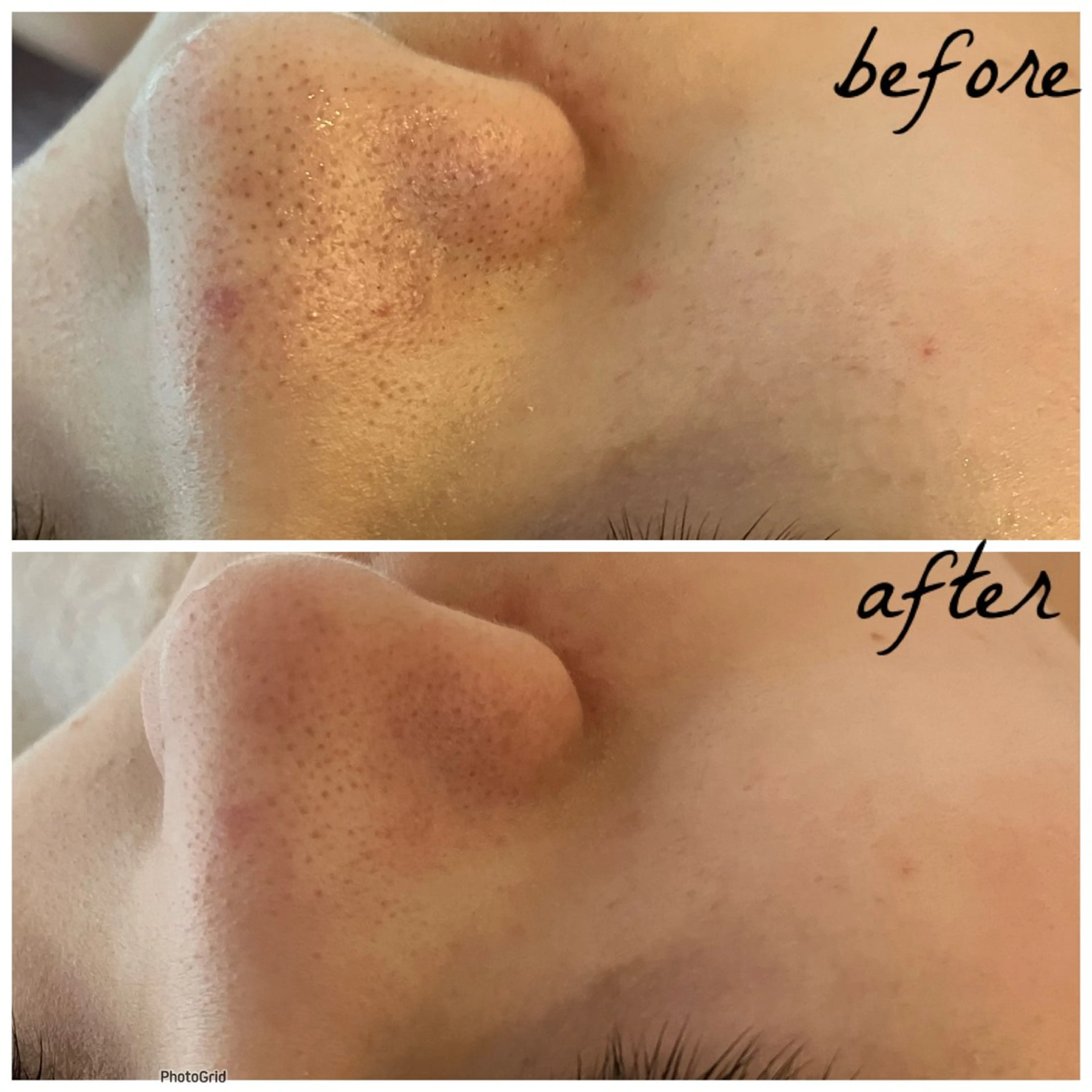 メンズ メナード岐阜茜部 杉浦のエステ・リラクイメージ