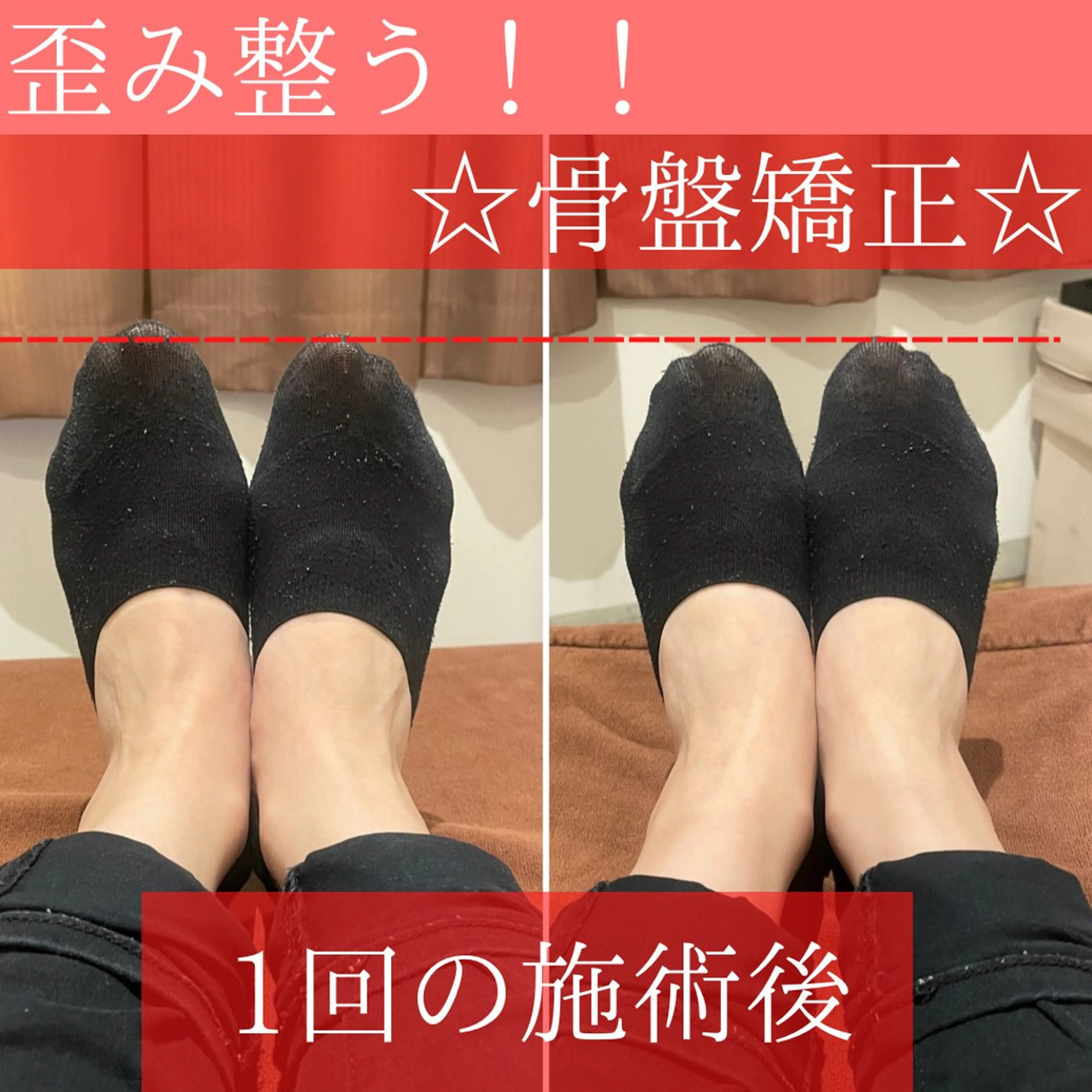 《初回限定》🦴【下半身の疲れ・腰がつらいに◎】こりとりコルギ＋骨盤調整💫 90分の写真