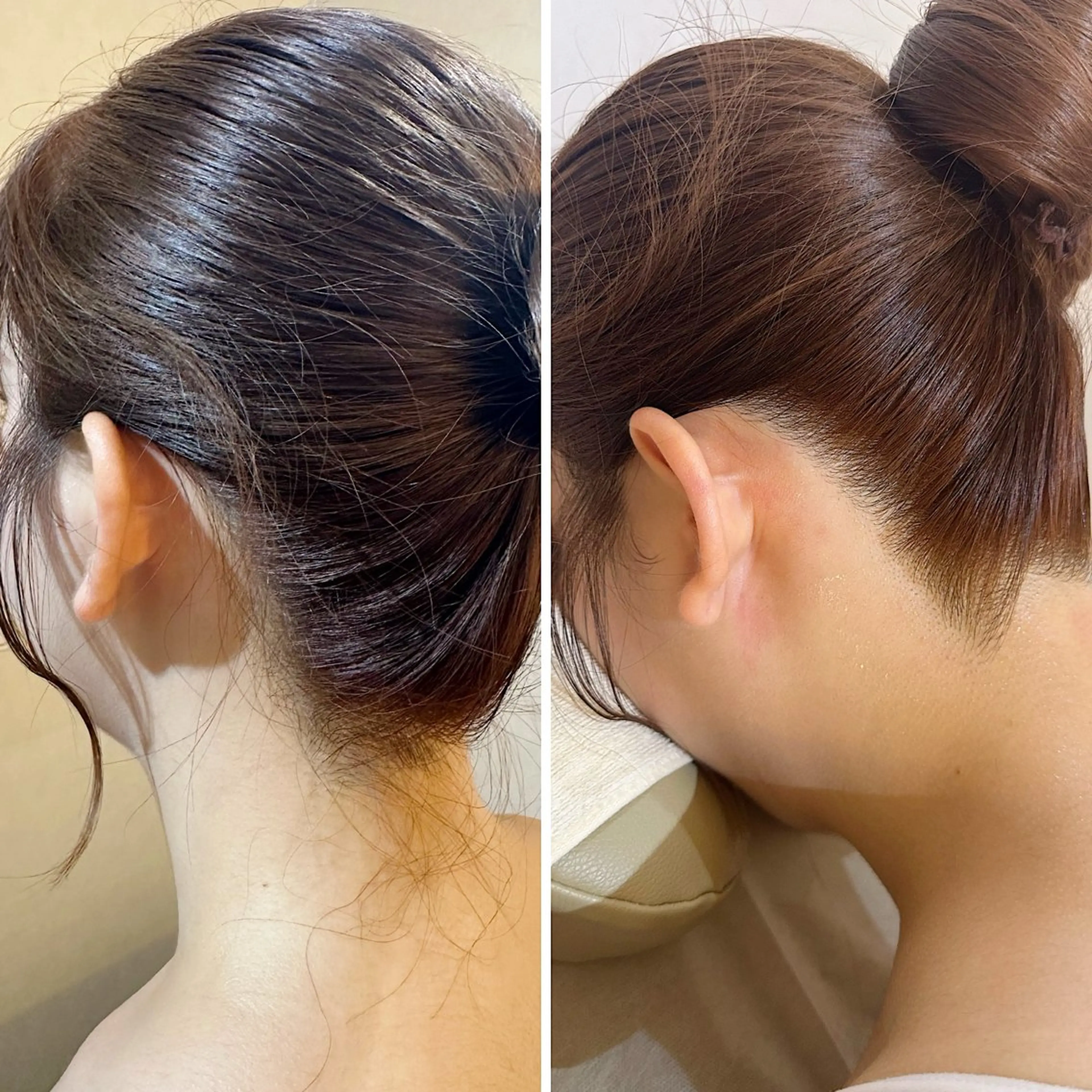 脱毛 うなじ脱毛/美肌脱毛 LABELのエステ・リラクイメージ