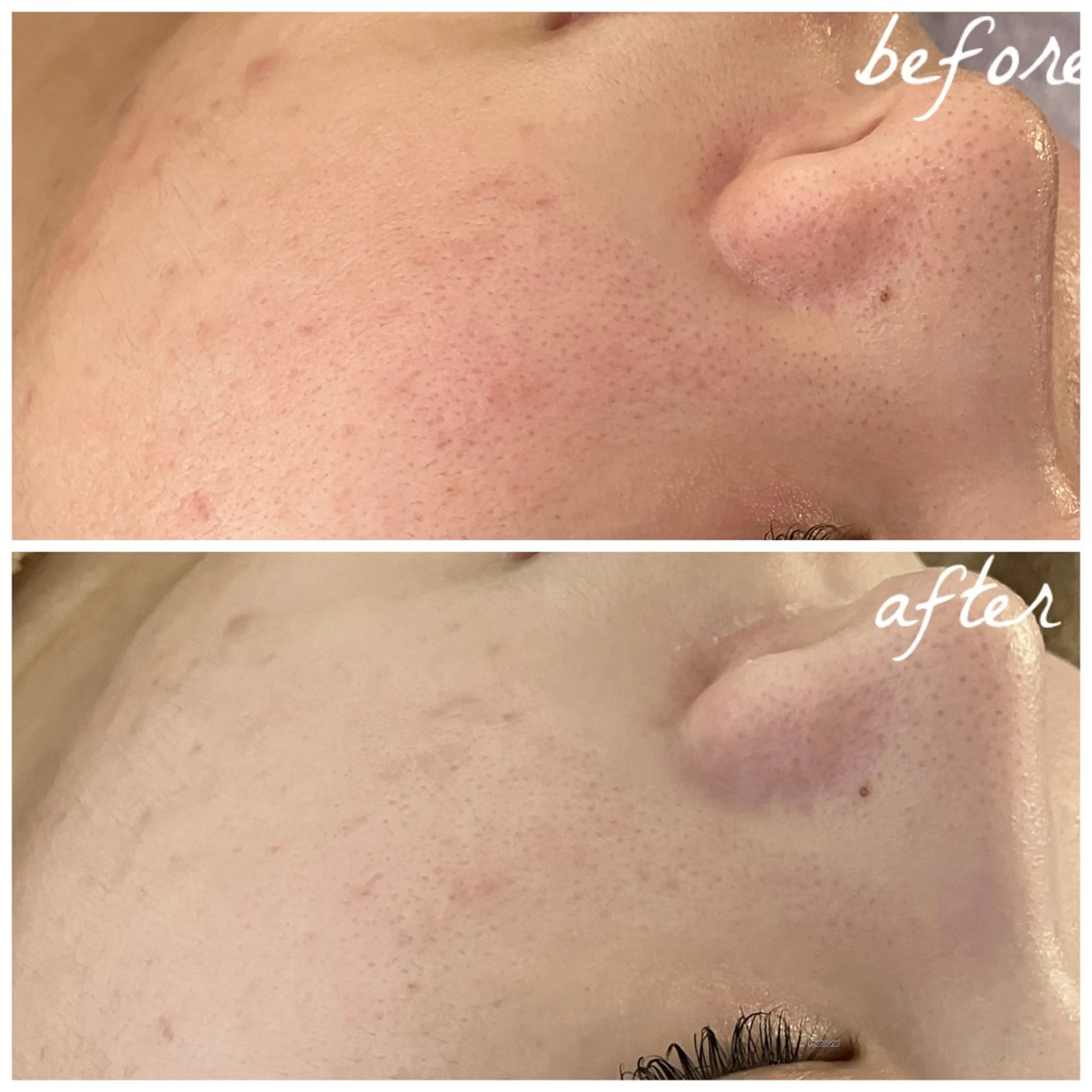 メンズ エステ メナード岐阜茜部 杉浦のエステ・リラクイメージ