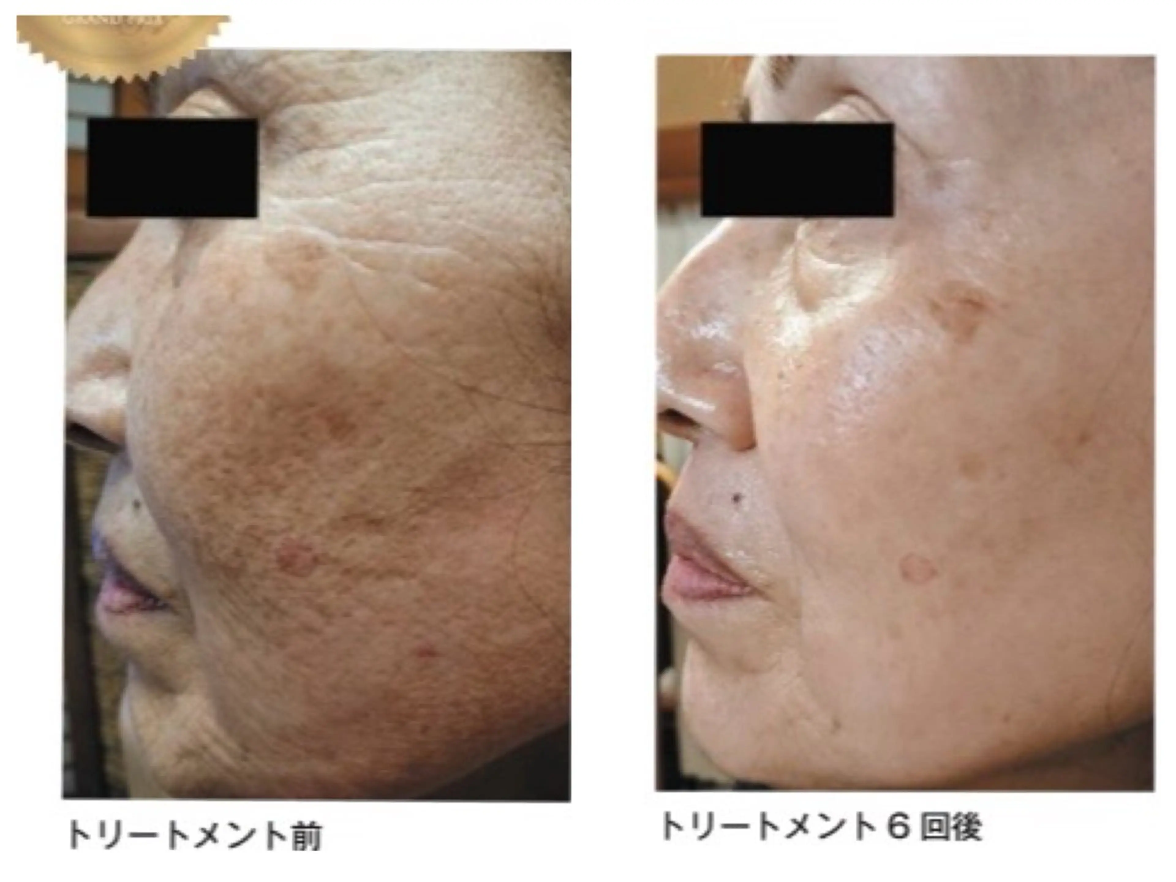 トータルスキンケア美容Room所属・トータルスキンケア 美容Roomのエステ・リラクイメージ