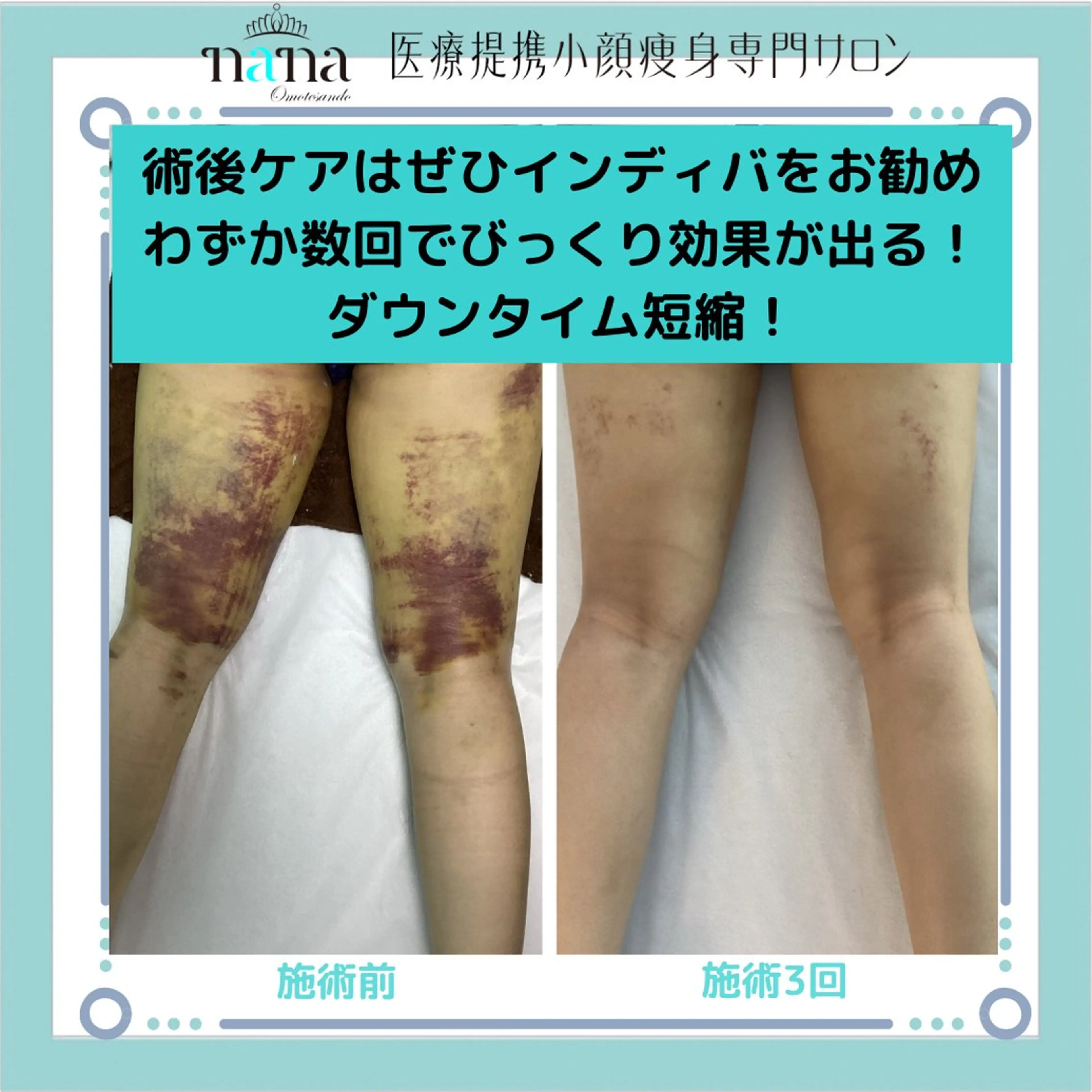 エステ リラク 小顔痩身インディバ Nana表参道のエステ・リラクイメージ