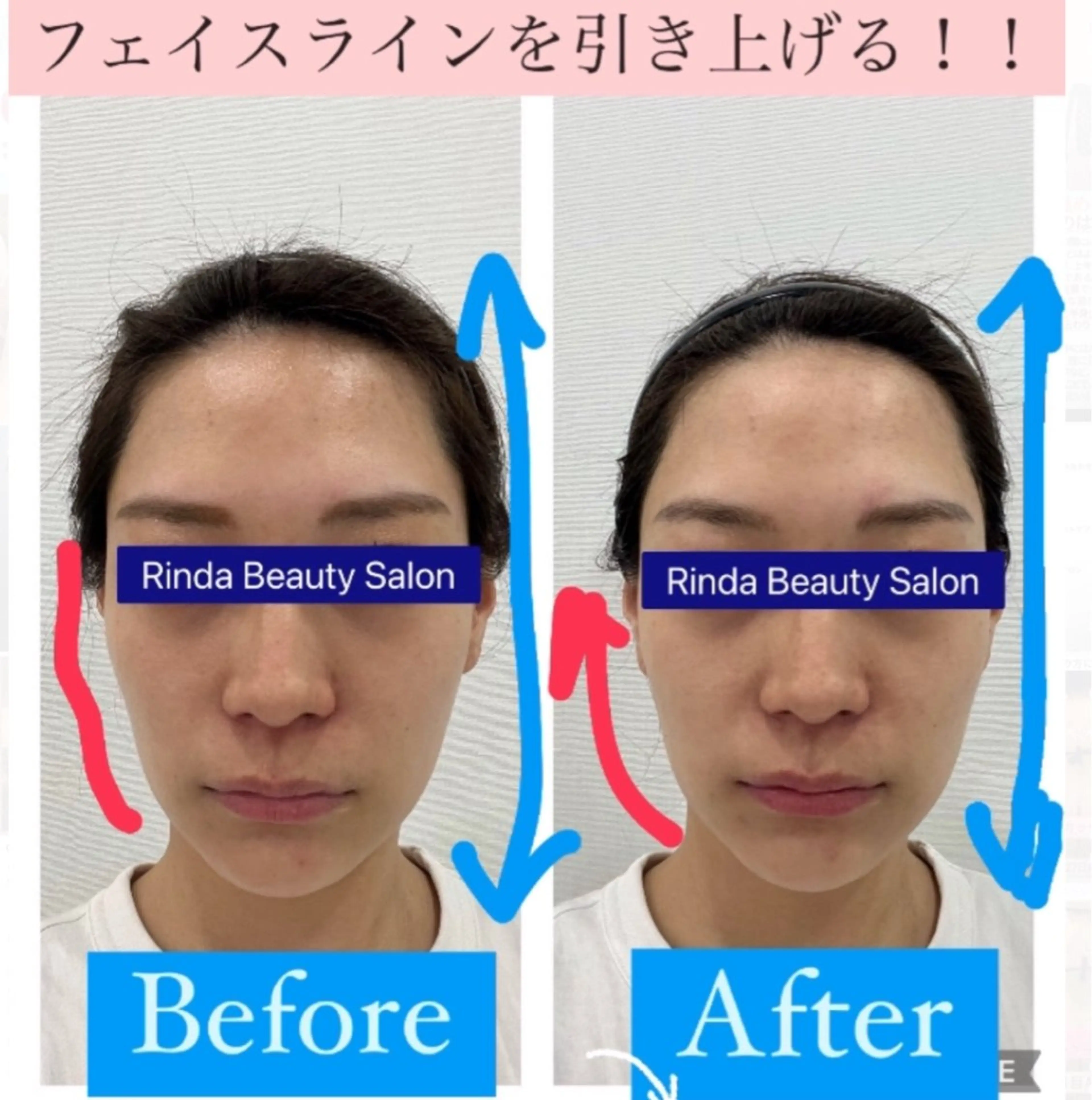 Rinda 尼崎駅前サロンのエステ・リラクイメージ