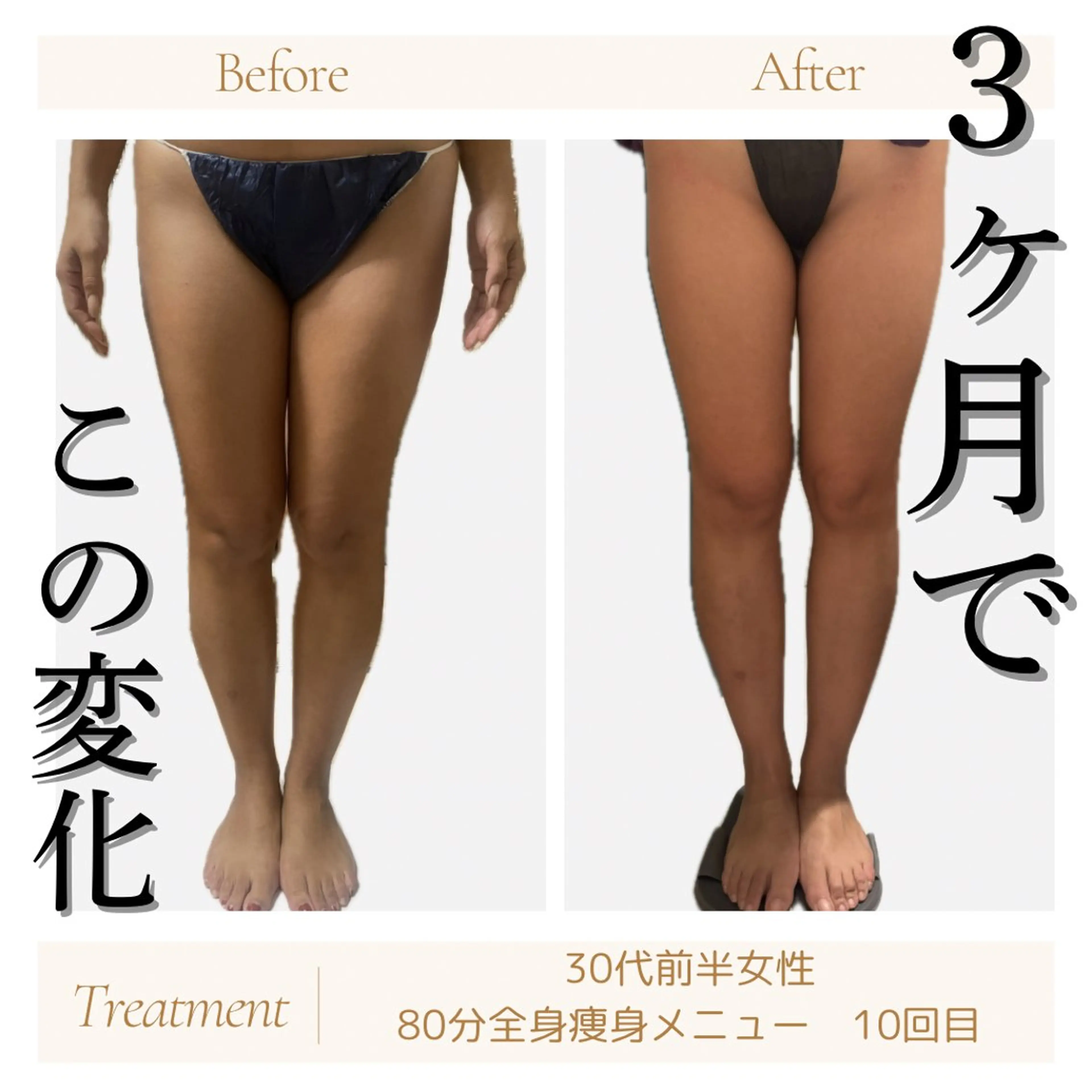 京橋 痩身エステ専門サロン BOSS  BODY所属・京橋痩身エステ専門サ ロンBOSSBODYのエステ・リラクイメージ