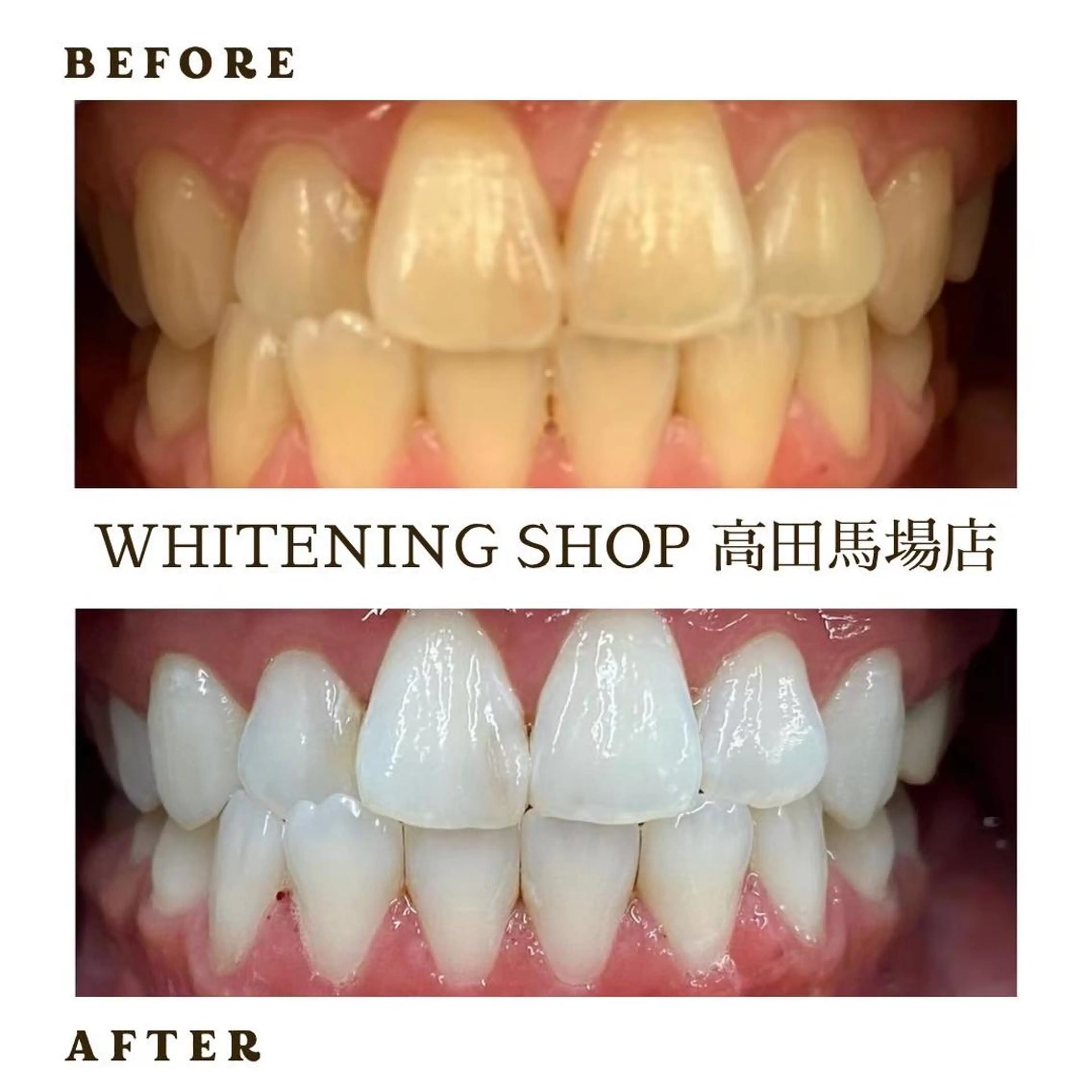 メンズ その他 ホワイトニング ショップ高田馬場店のその他イメージ