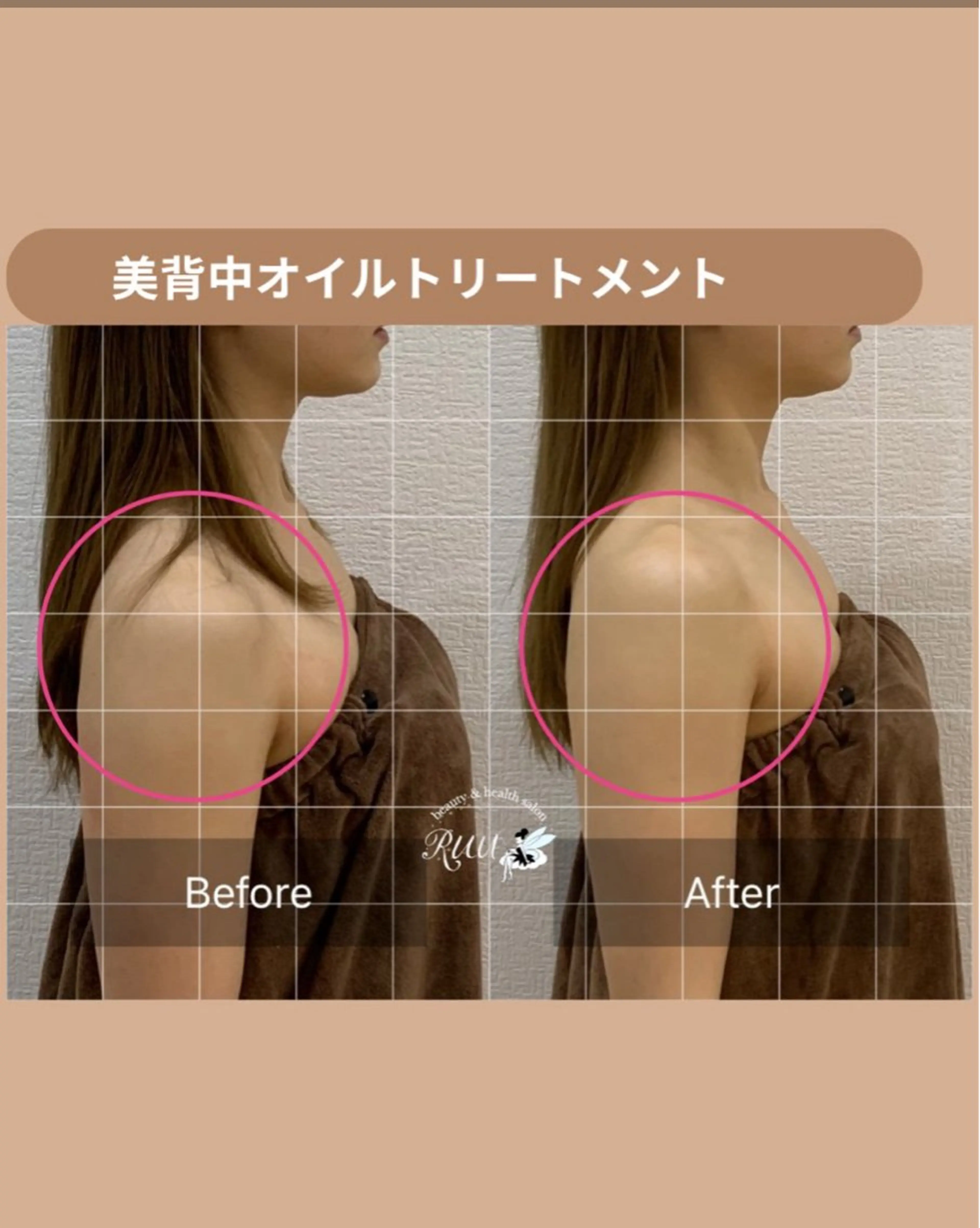 エステ リラク 【頭痛、睡眠改善】 salon RUUのエステ・リラクイメージ