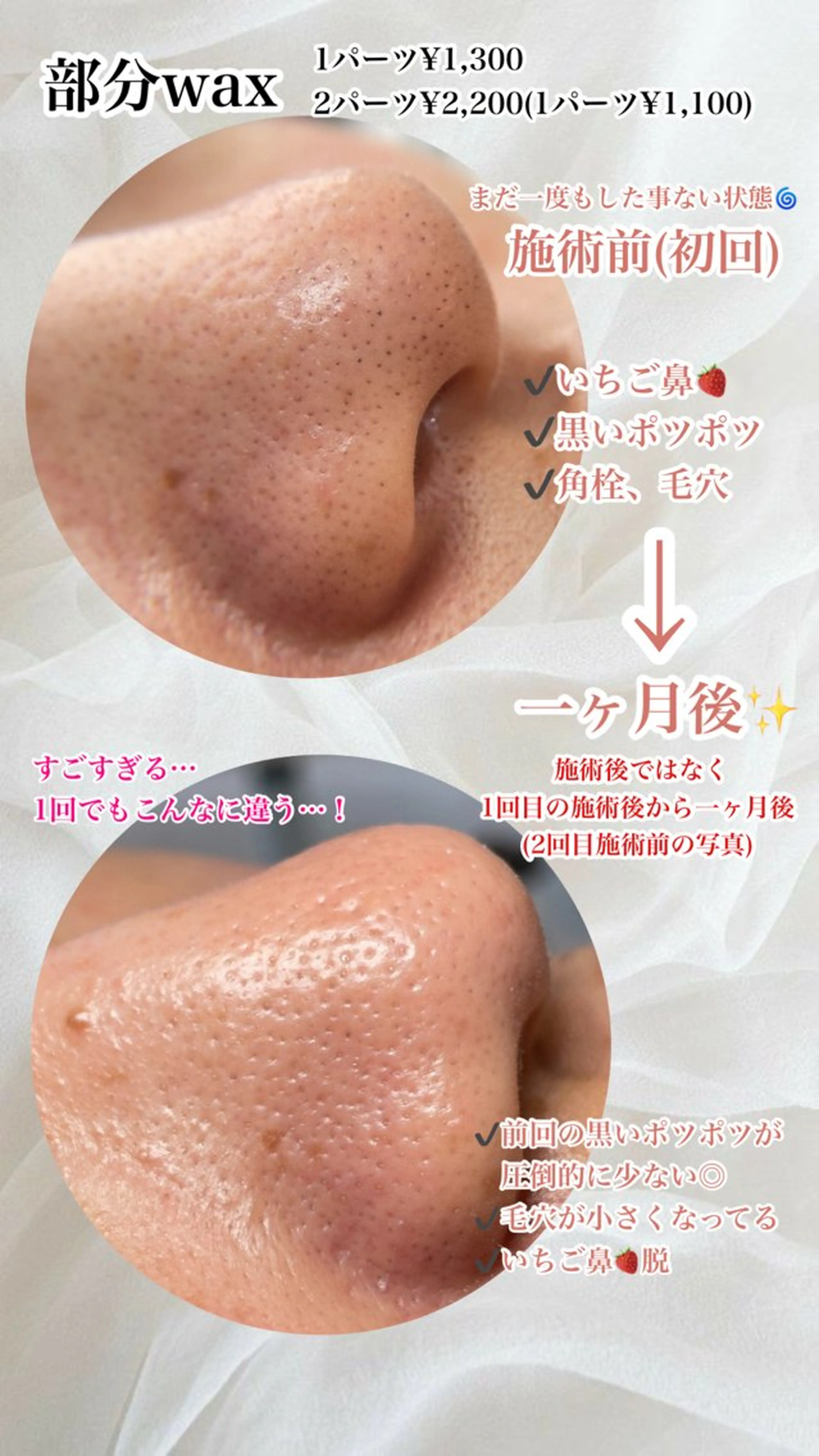 新宿人気No1サロン Onze【オンズ】のマツエク・マツパデザイン