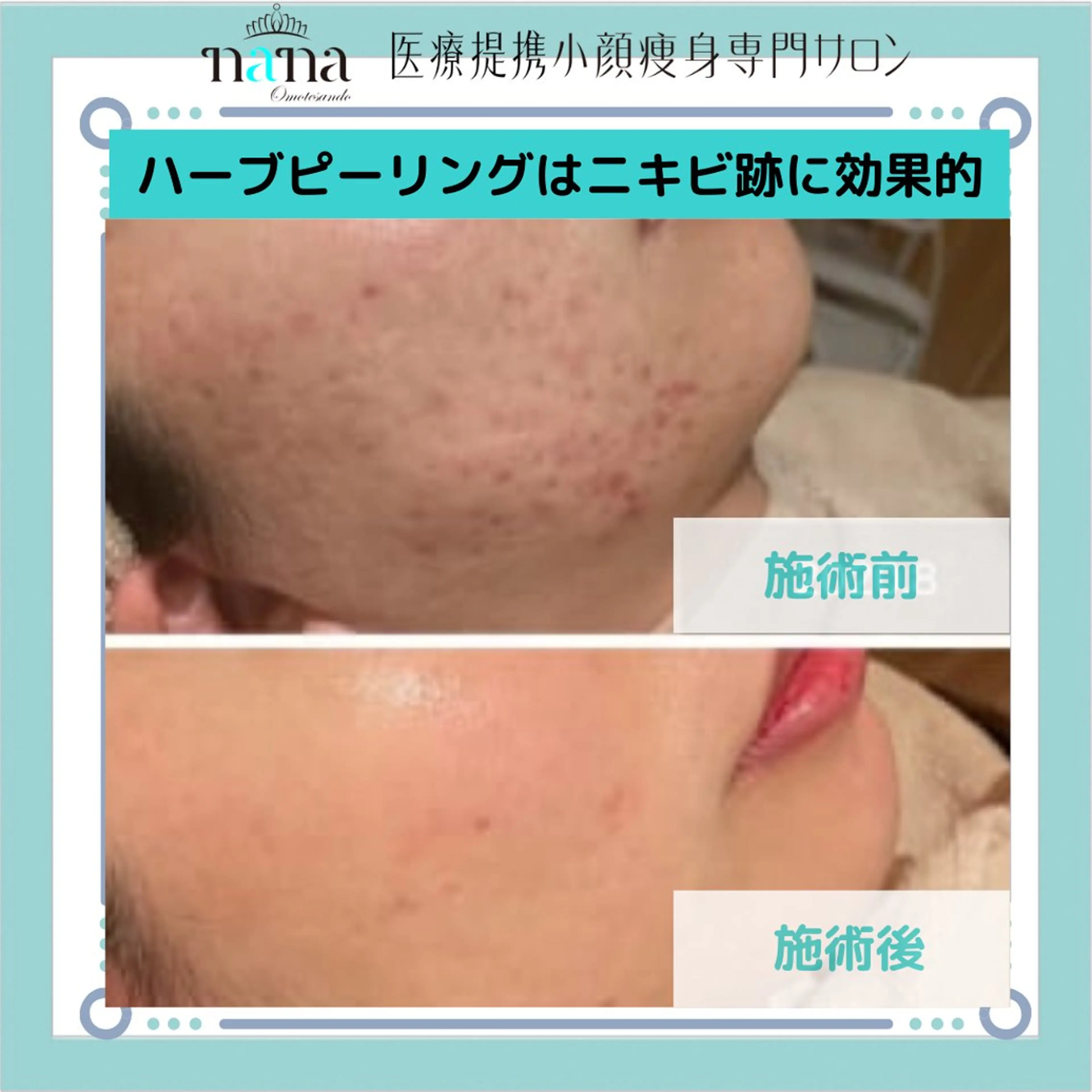 小顔痩身インディバ Nana表参道のエステ・リラクイメージ