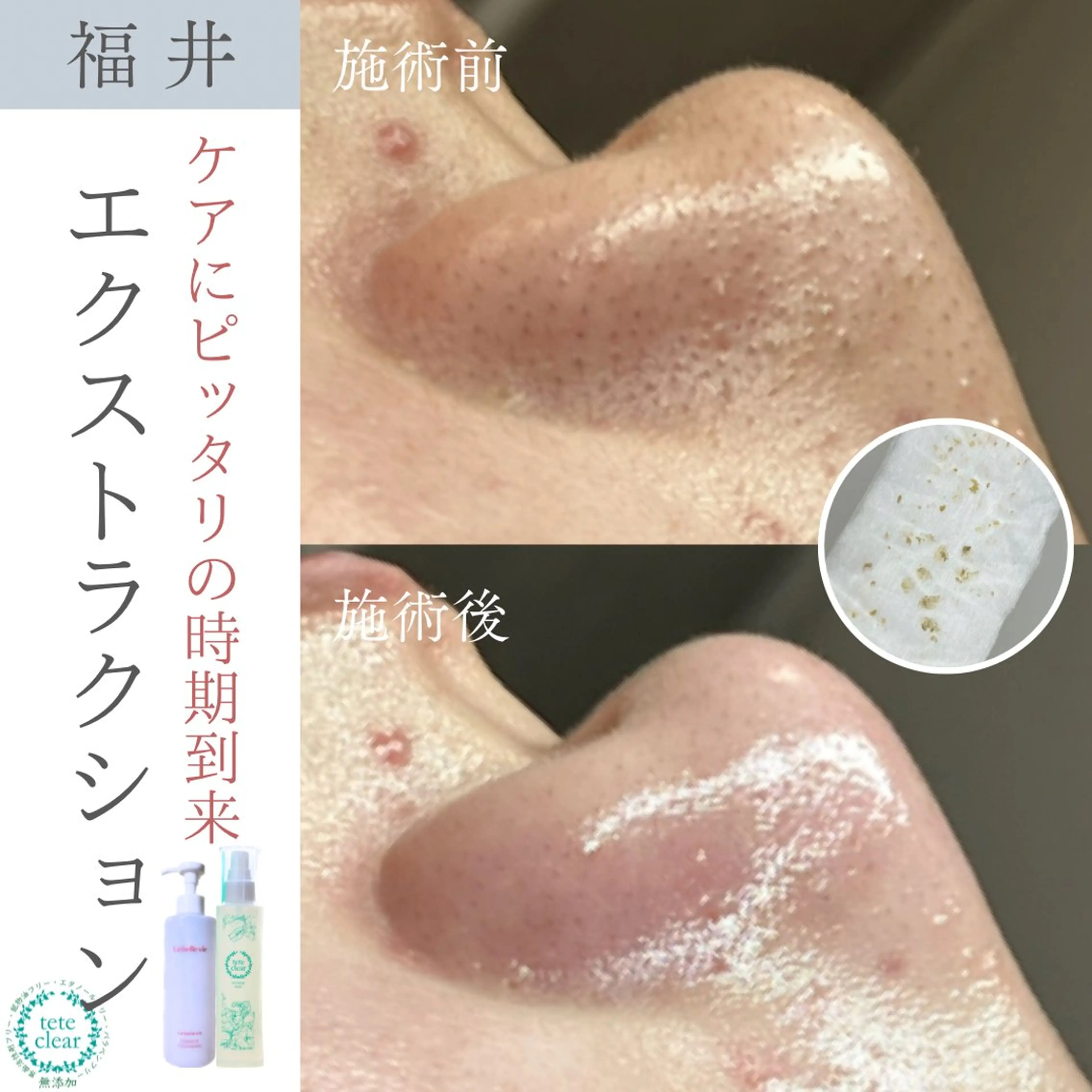 毛穴ケア専門サロン Yourmeユアミーのエステ・リラクイメージ